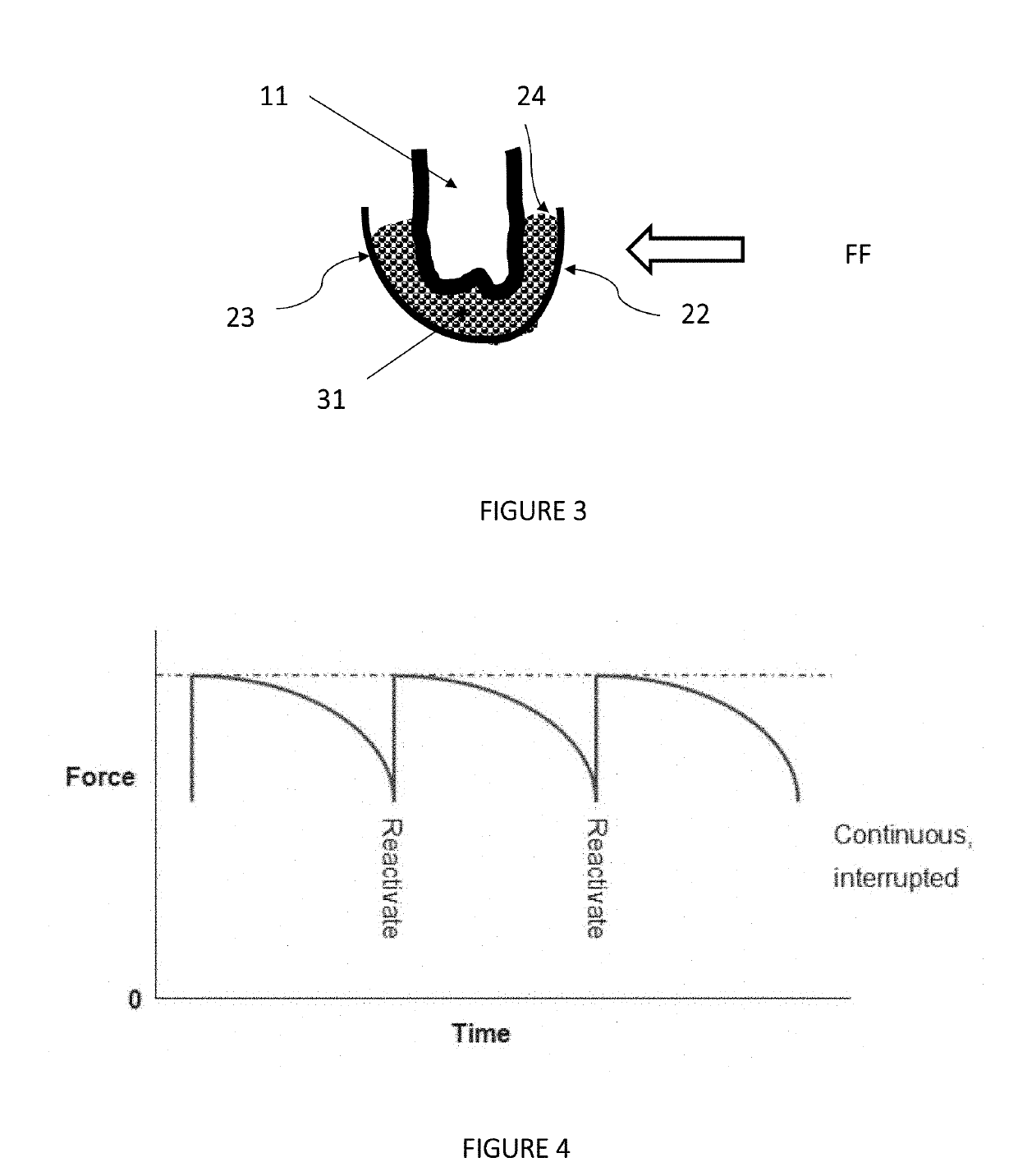 Teeth Aligner System