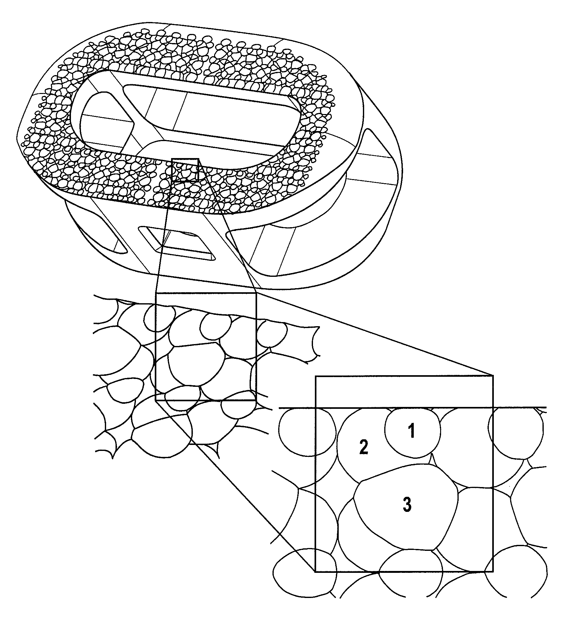 Microstructured implant surfaces