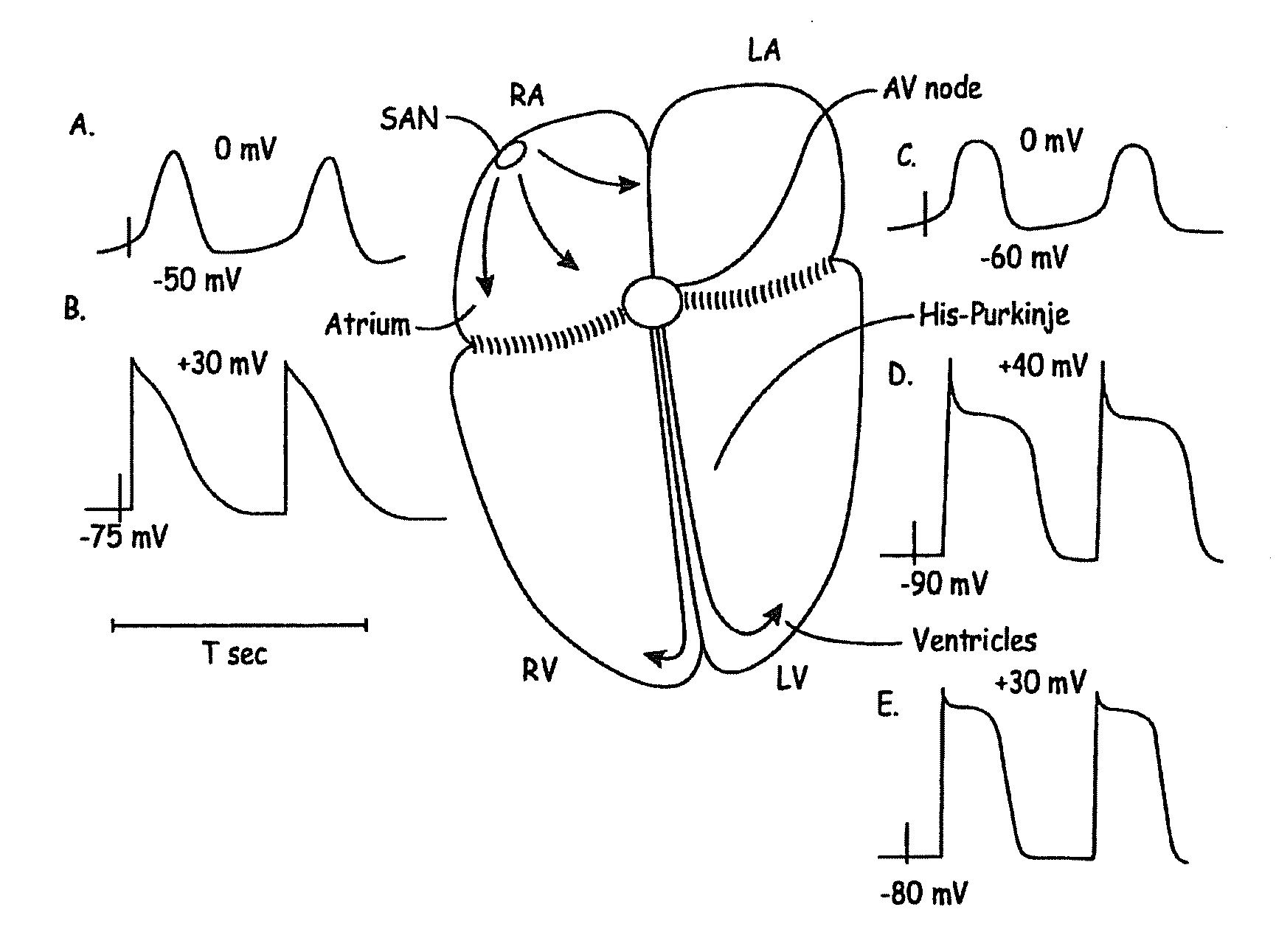 Rate control during af using cellular intervention to modulate av node