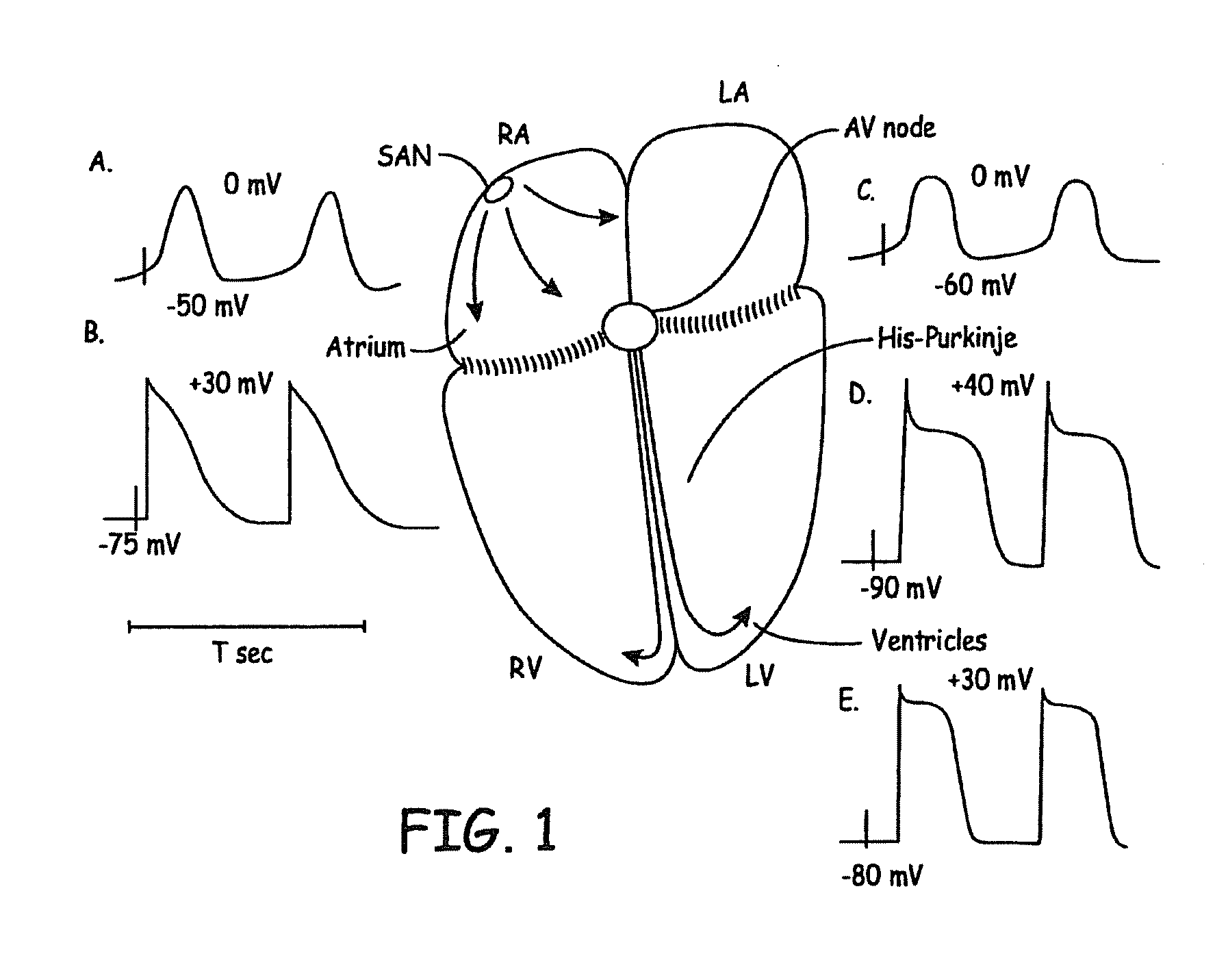 Rate control during af using cellular intervention to modulate av node