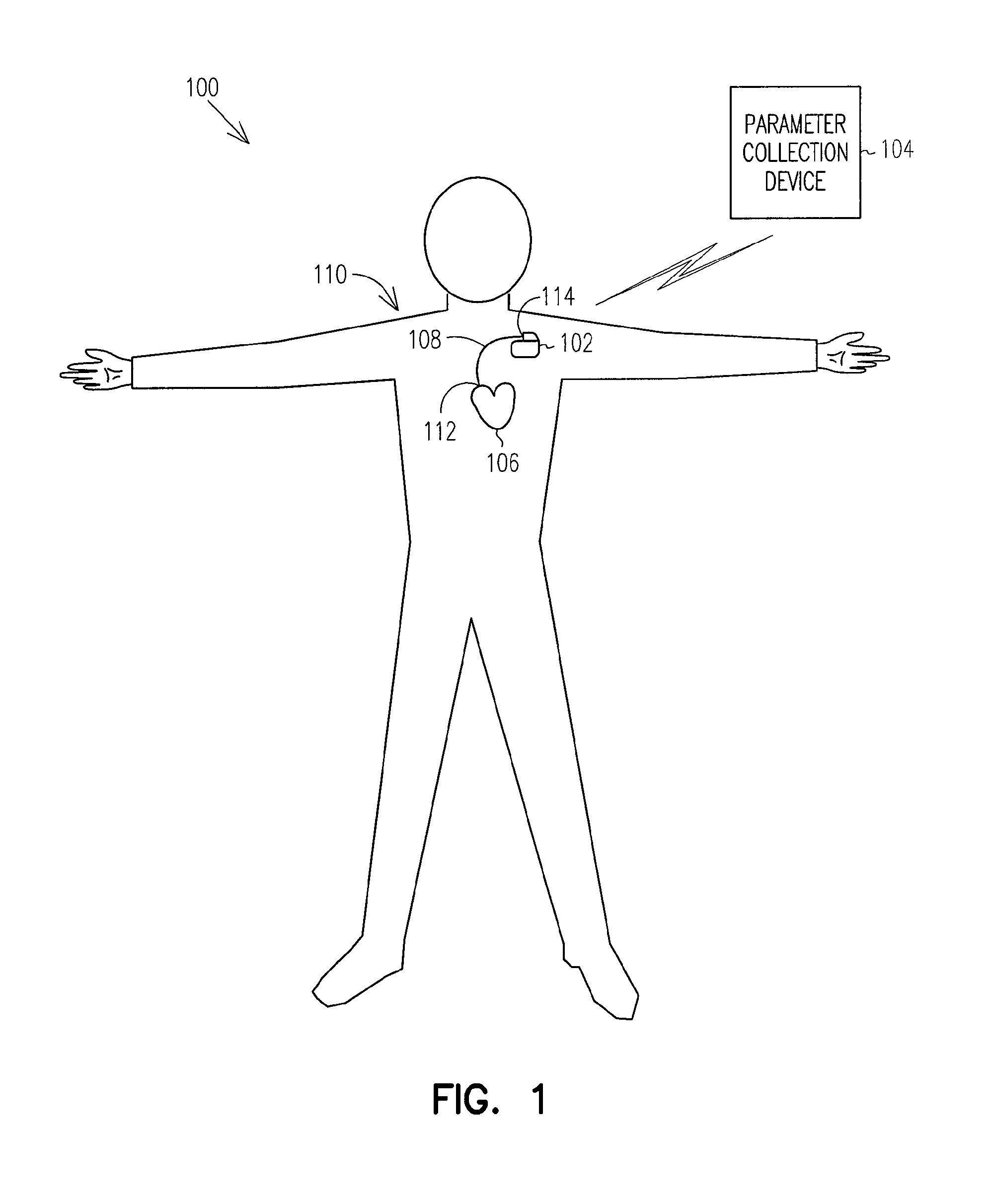 Prediction of thoracic fluid accumulation