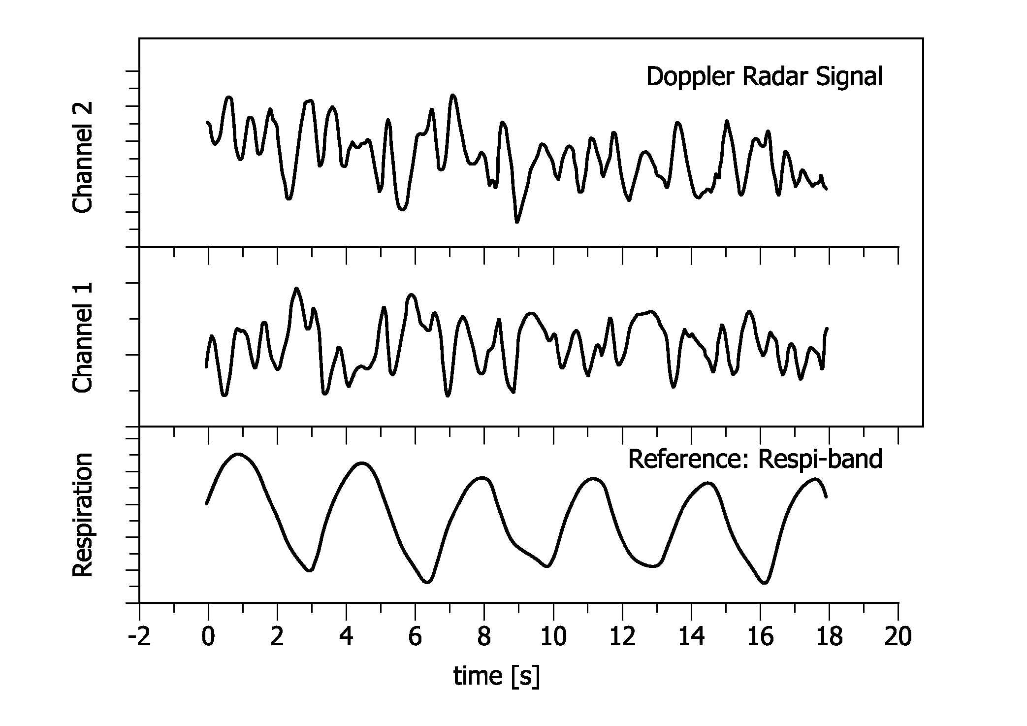 Contactless respiration monitoring of a patient