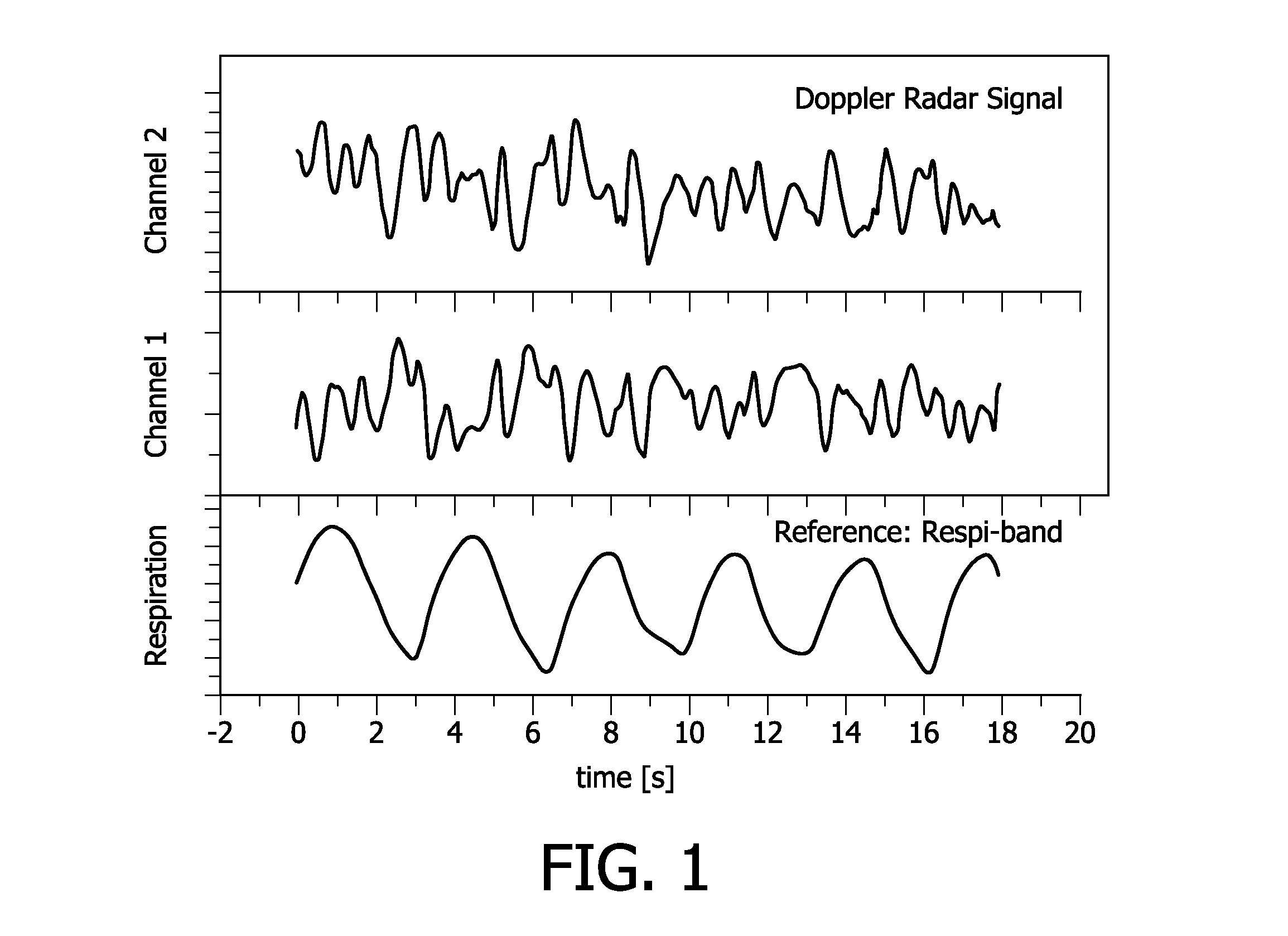 Contactless respiration monitoring of a patient