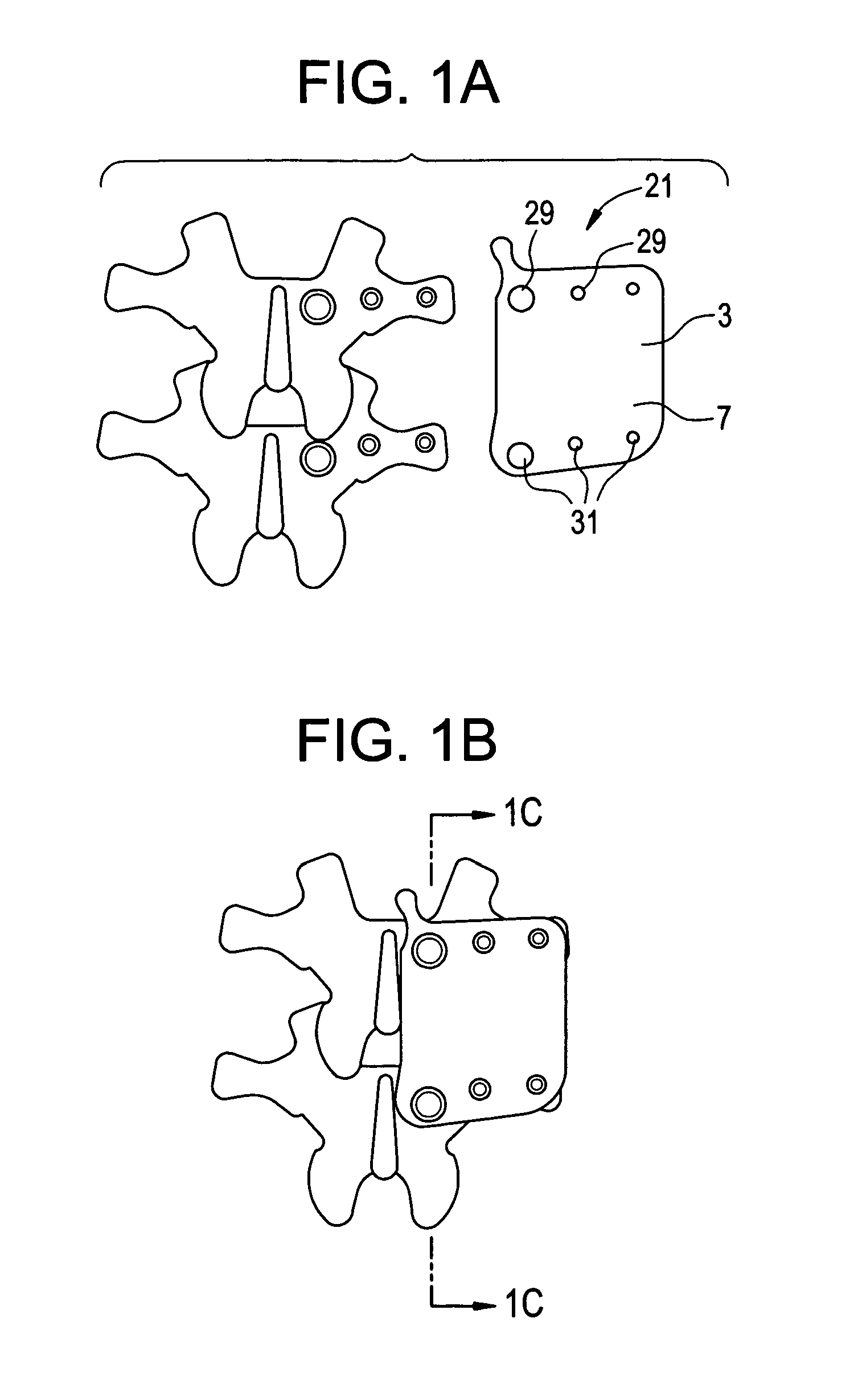 In-situ formed posterolateral fusion system