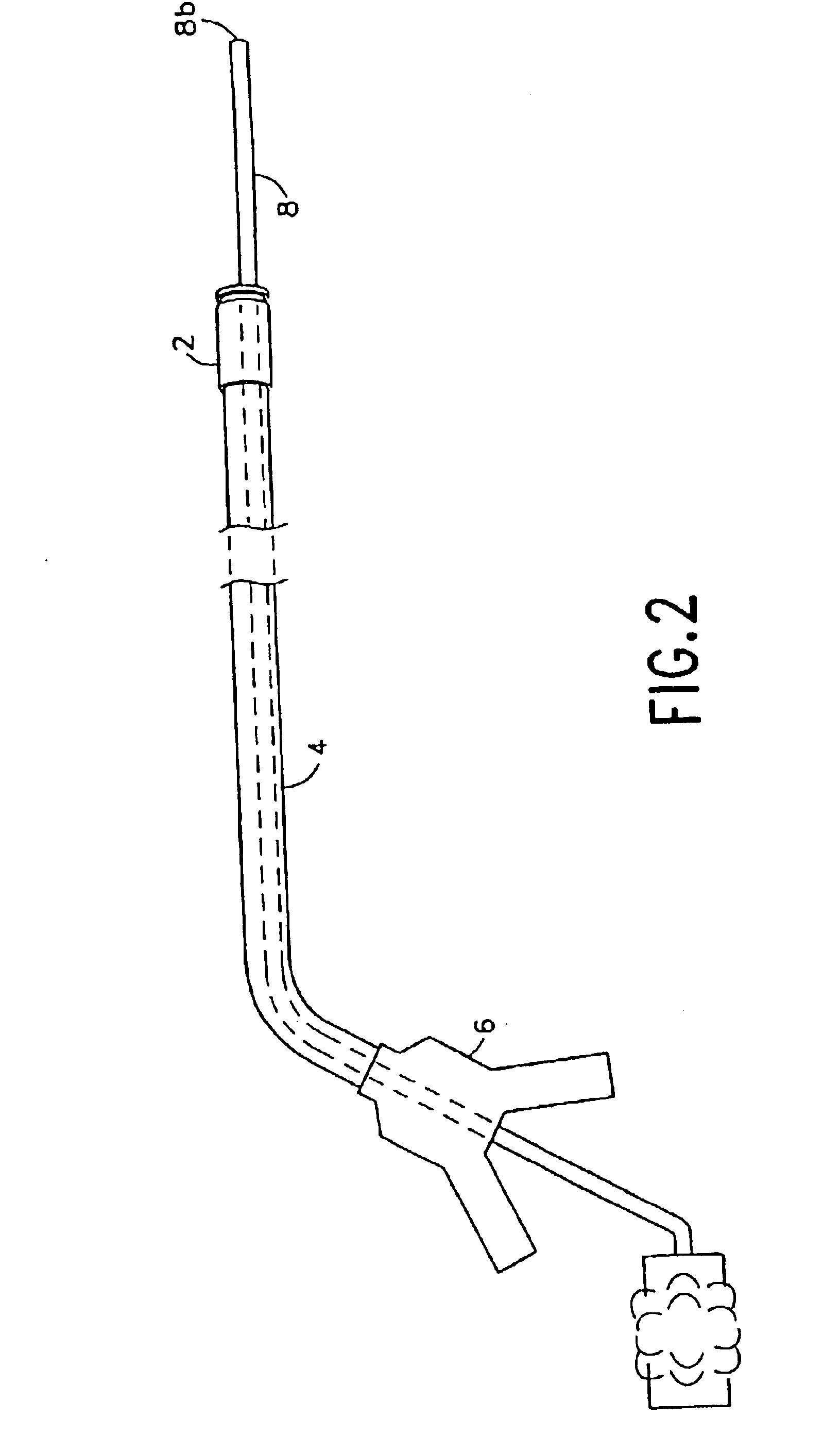 Integrated surgical staple retainer for a full thickness resectioning device