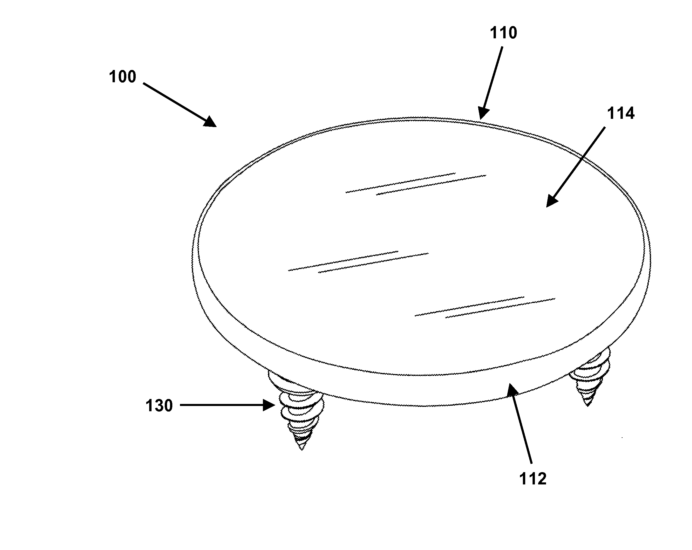 Rim Anchoring Systems for Flexible Surgical Implants for Replacing Cartilage