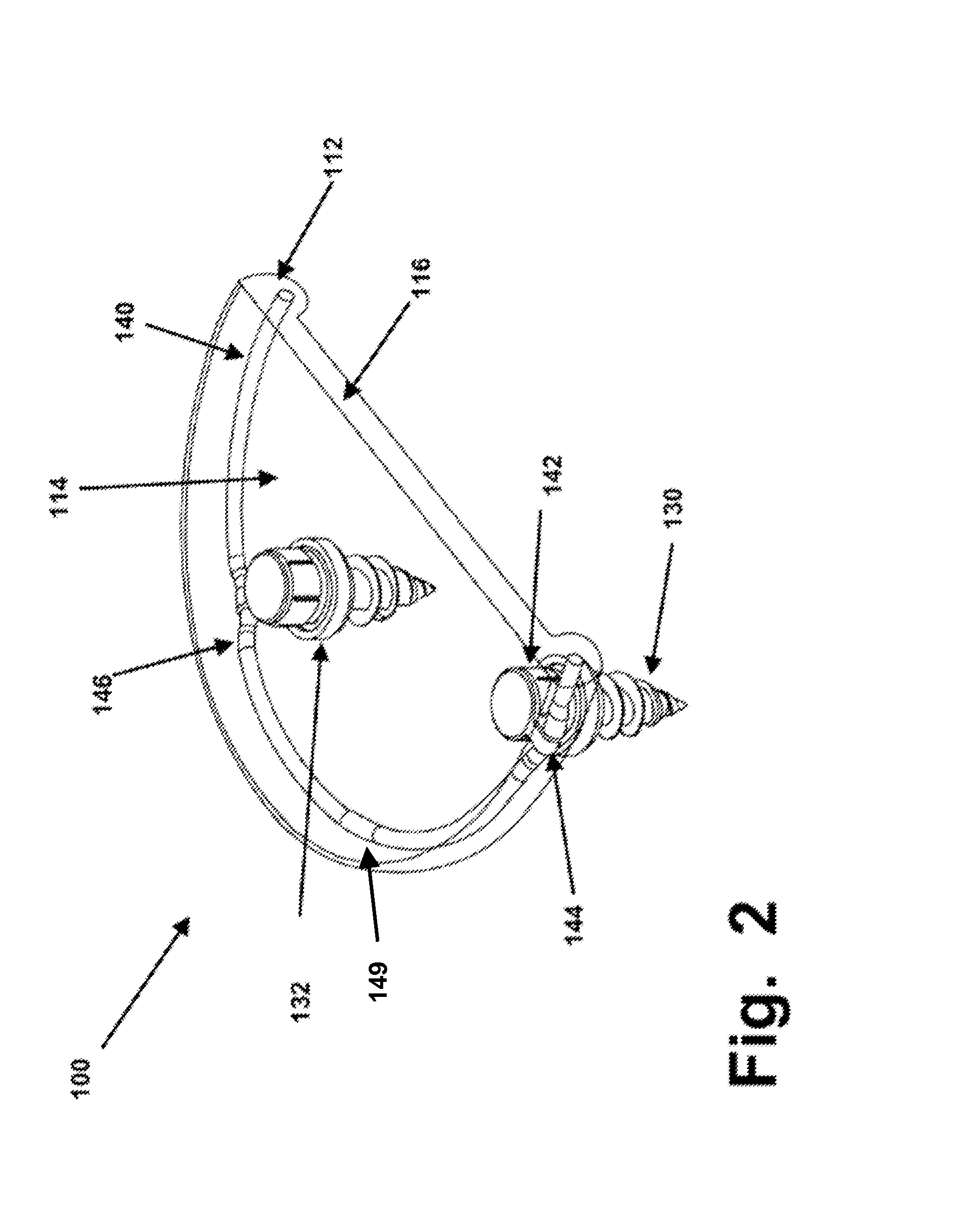 Rim Anchoring Systems for Flexible Surgical Implants for Replacing Cartilage