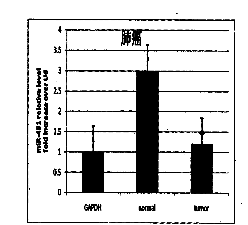 Application of miR-451 in preparing medicine for treating non-small cell lung cancer