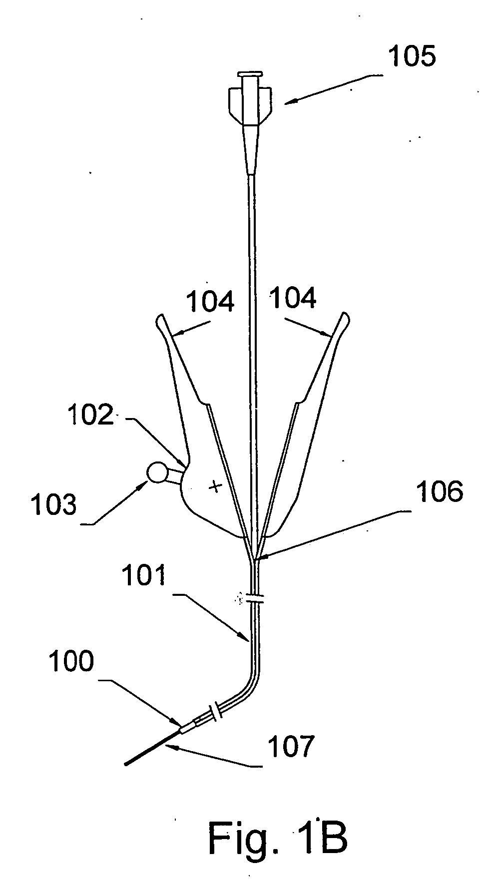 Methods of using a telescoping guide catheter with peel-away outer sheath