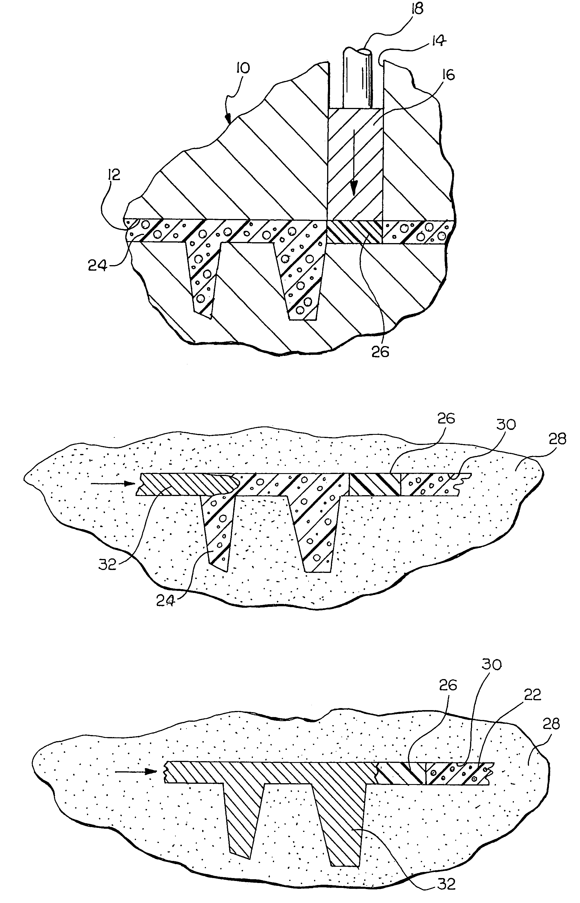 Method and apparatus for controlling dispersion of molten metal in a mold cavity