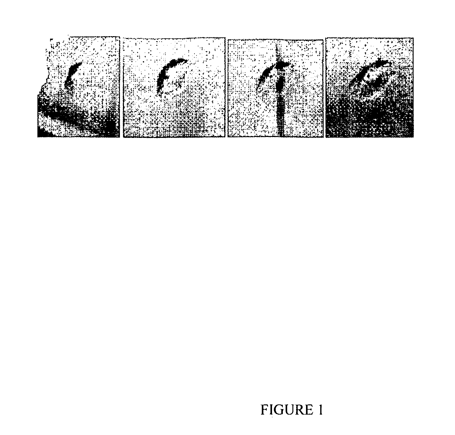 Sustained-Release Formulations Comprising Crystals, Macromolecular Gels, and Particulate Suspensions of Biologic Agents