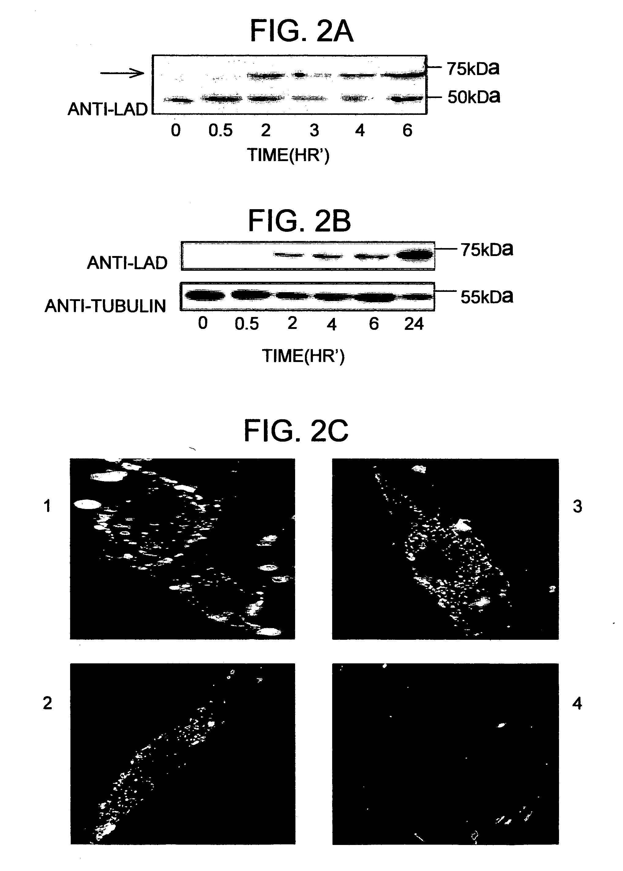 Methods and compositions for treatment of mitochondrial disorders