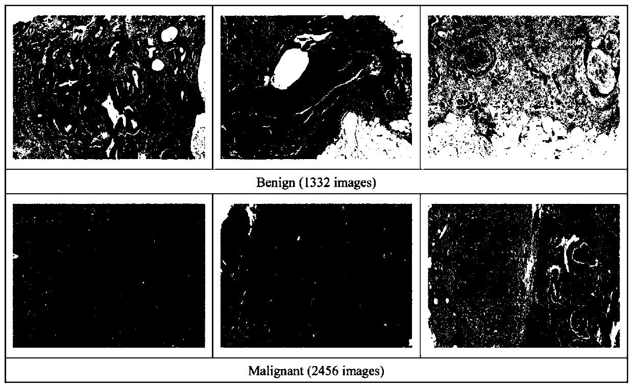 Pathological classification method and system based on multi-modal deep learning