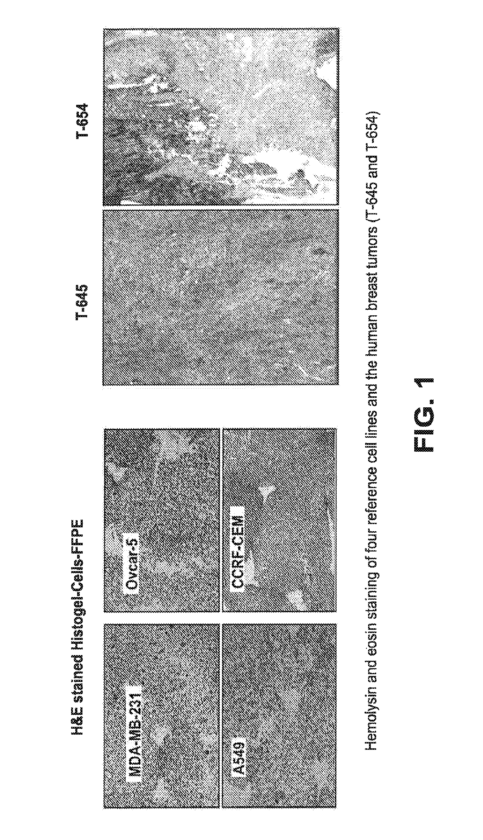 Telomere Length Measurement in Formalin-Fixed, Paraffin Embedded (FFPE) Samples by Quantitative PCR