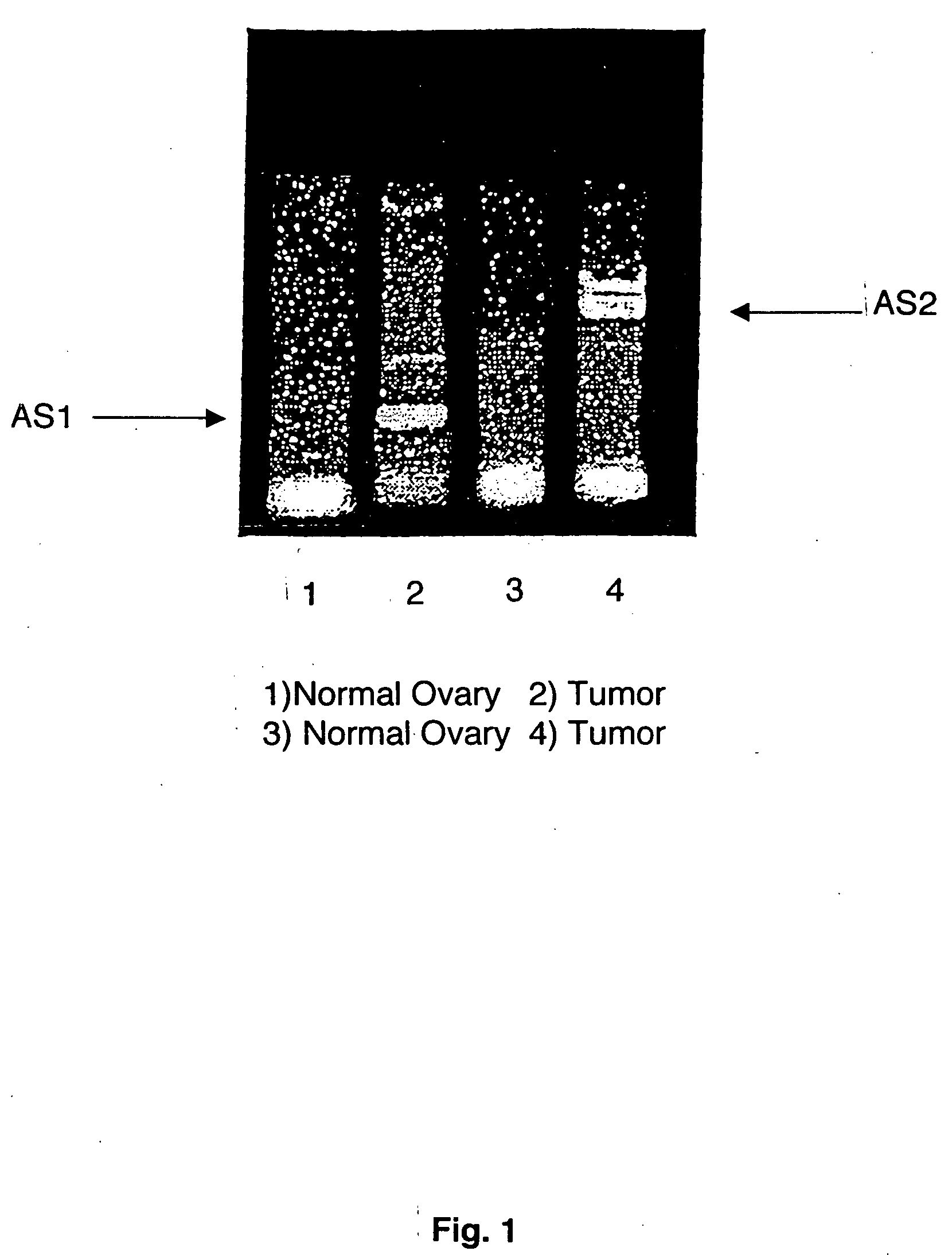 Extracellular serine protease