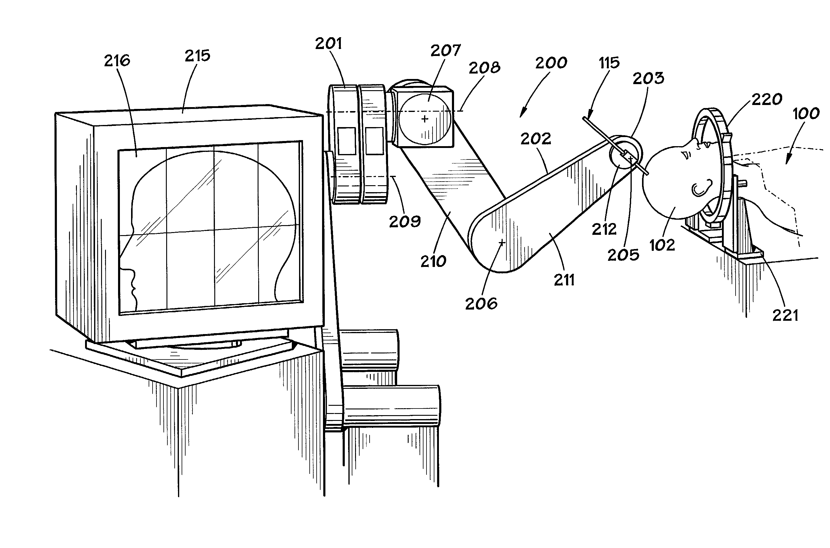 Hair transplantation method and apparatus