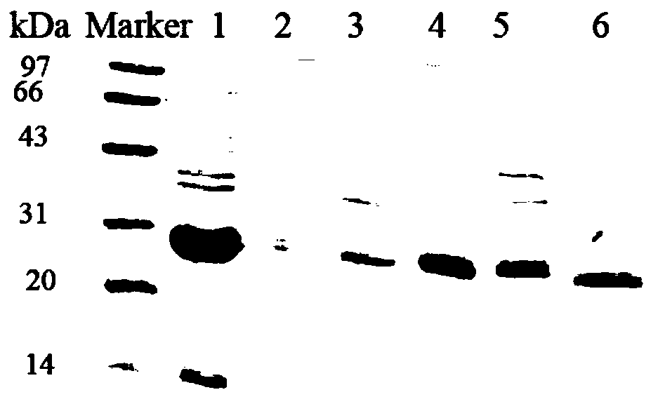 Antigen epitope polypeptide located on nostructal protein 1 of dengue virus and application of antigen epitope polypeptide