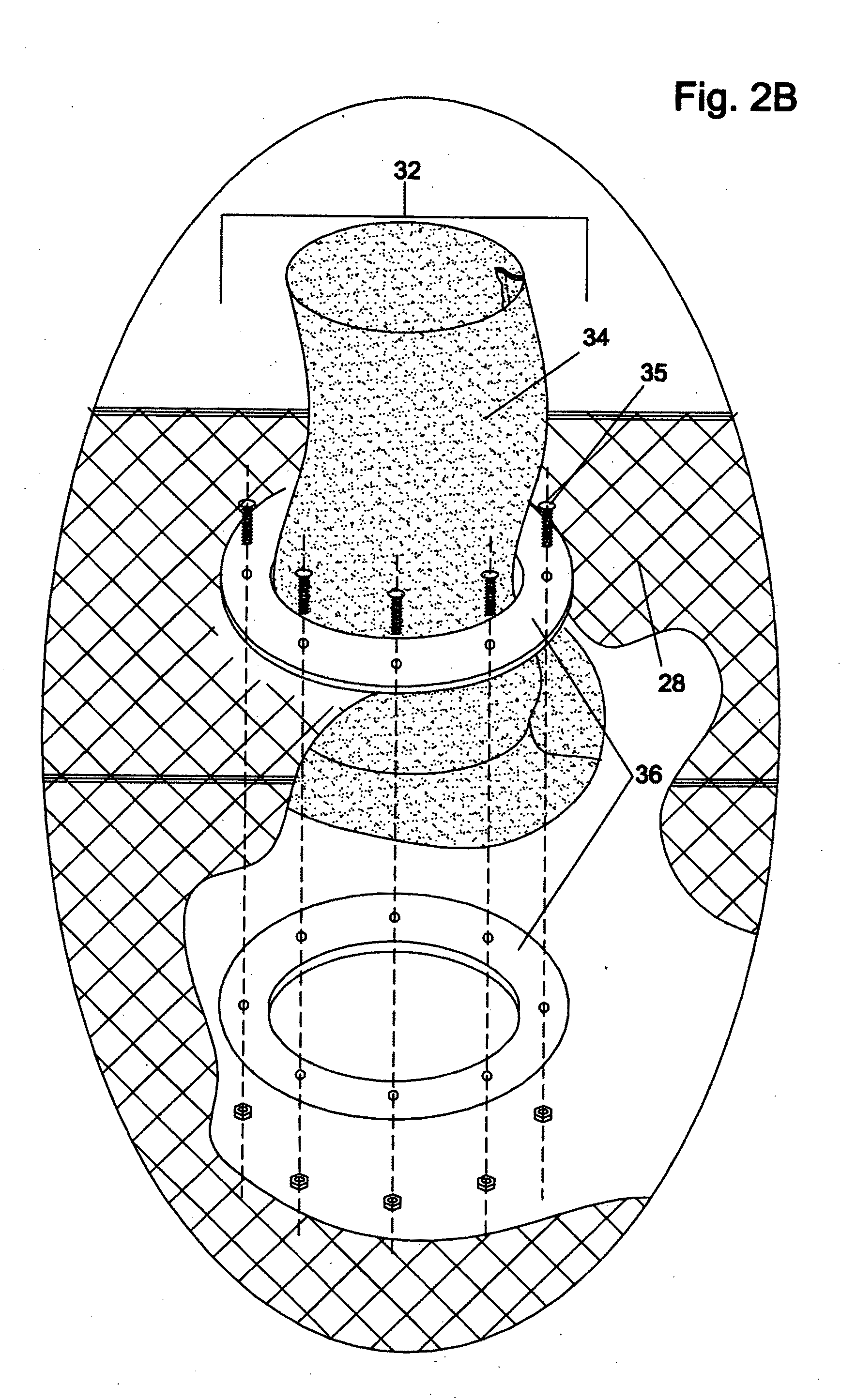 Method of dewatering solids laden liquids utilizing a reusable filter element