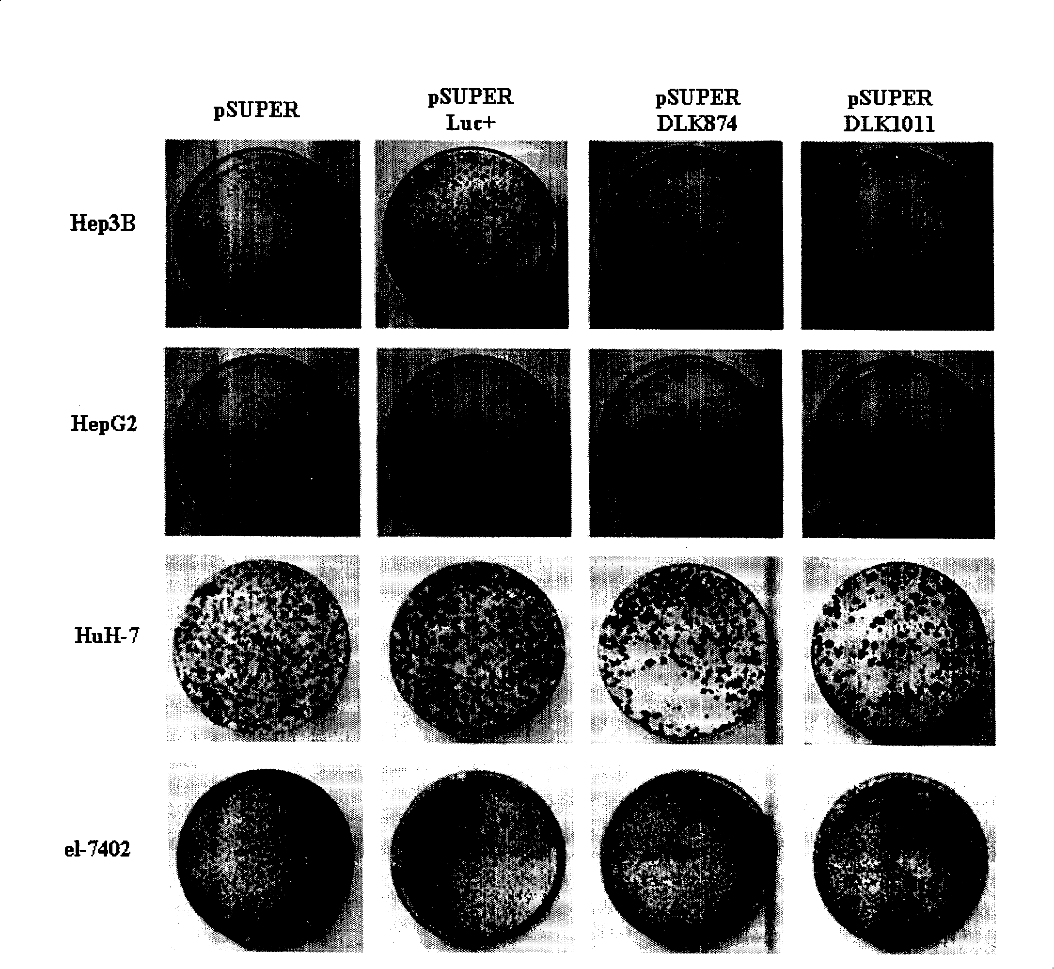 Liver cancer related gene DLK1 and uses thereof