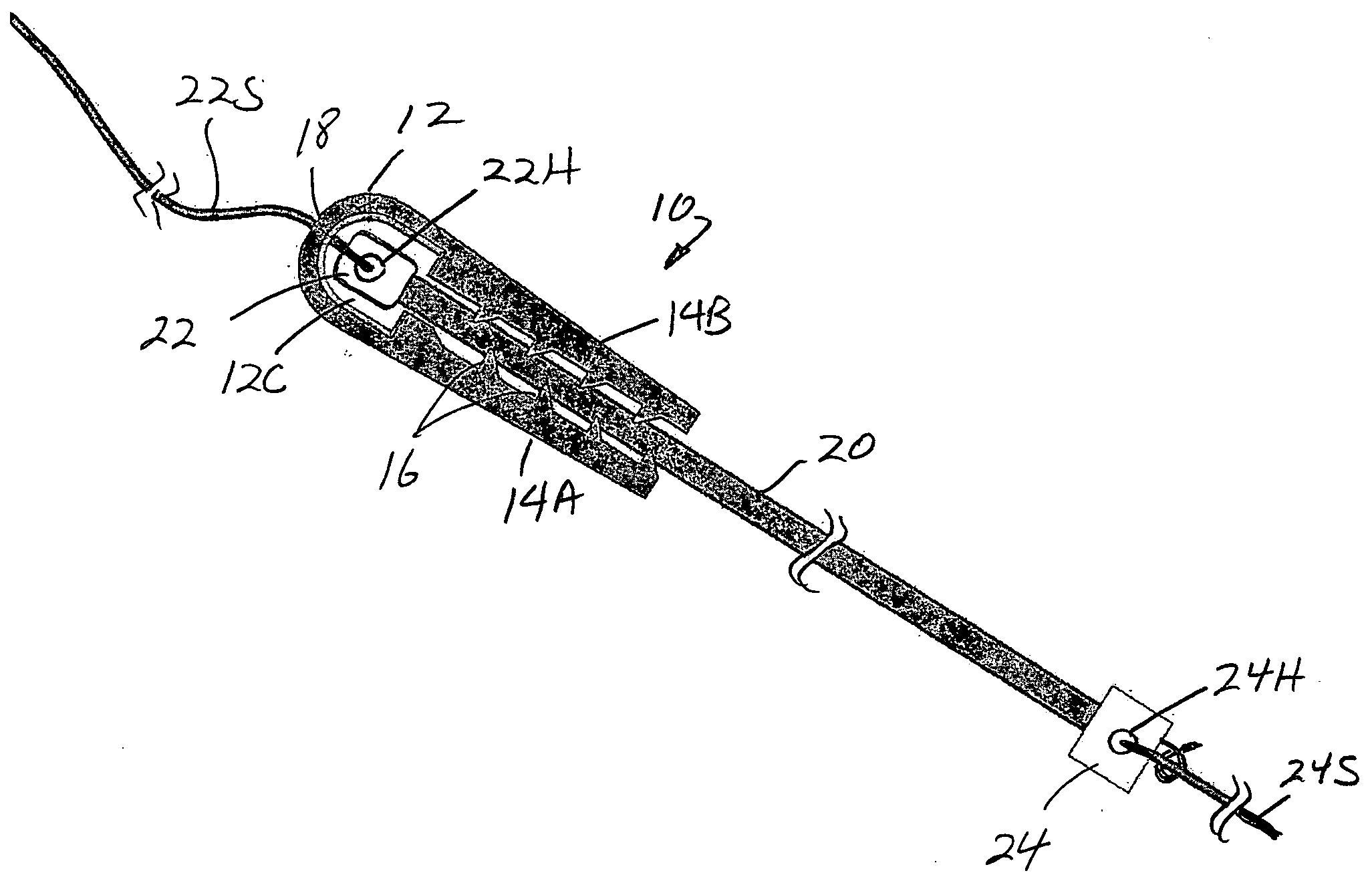 Tapered anchor for tendon graft