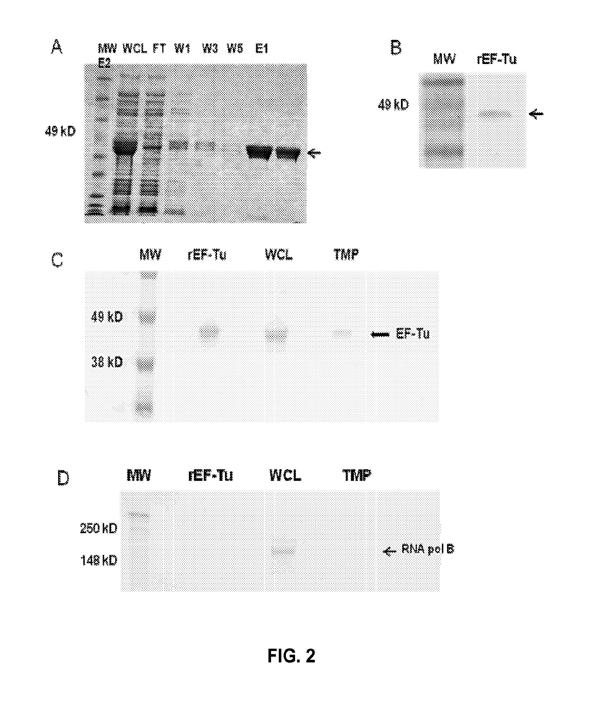 Omv vaccine against burkholderia infections