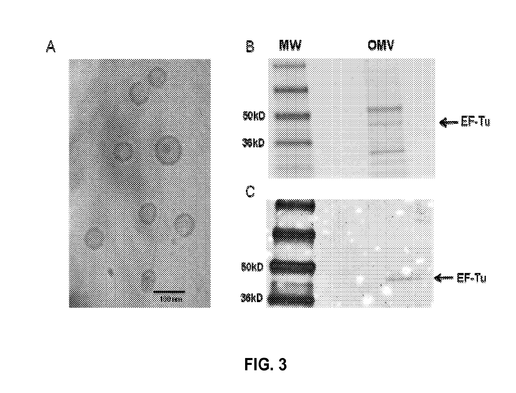 Omv vaccine against burkholderia infections