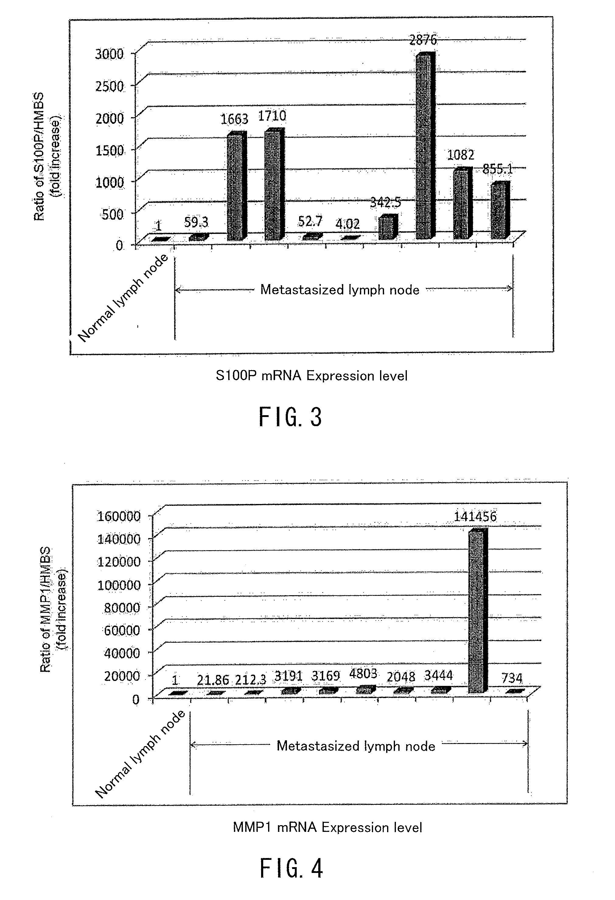 Method for analyzing cervical lymph node metastasis, and tumor marker for head and neck cancer