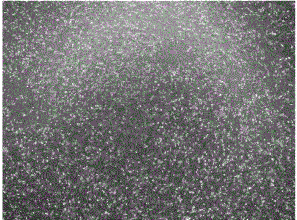 High-activity primary cartilage cell preparing method