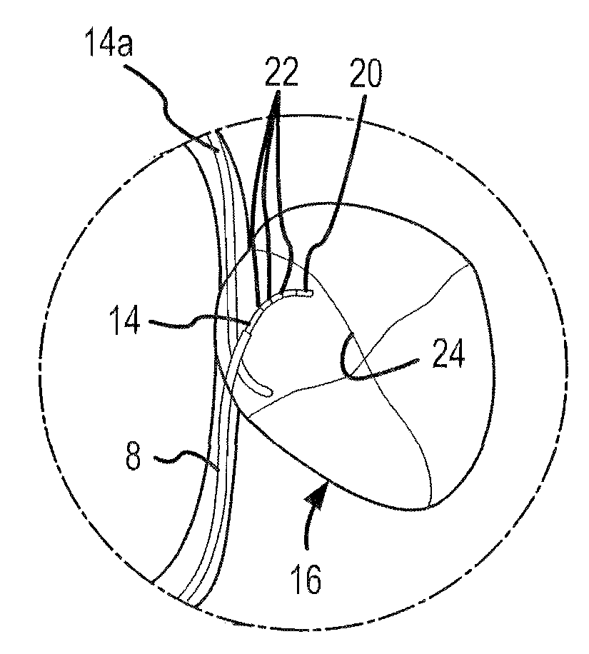 Contact sensor and sheath exit sensor