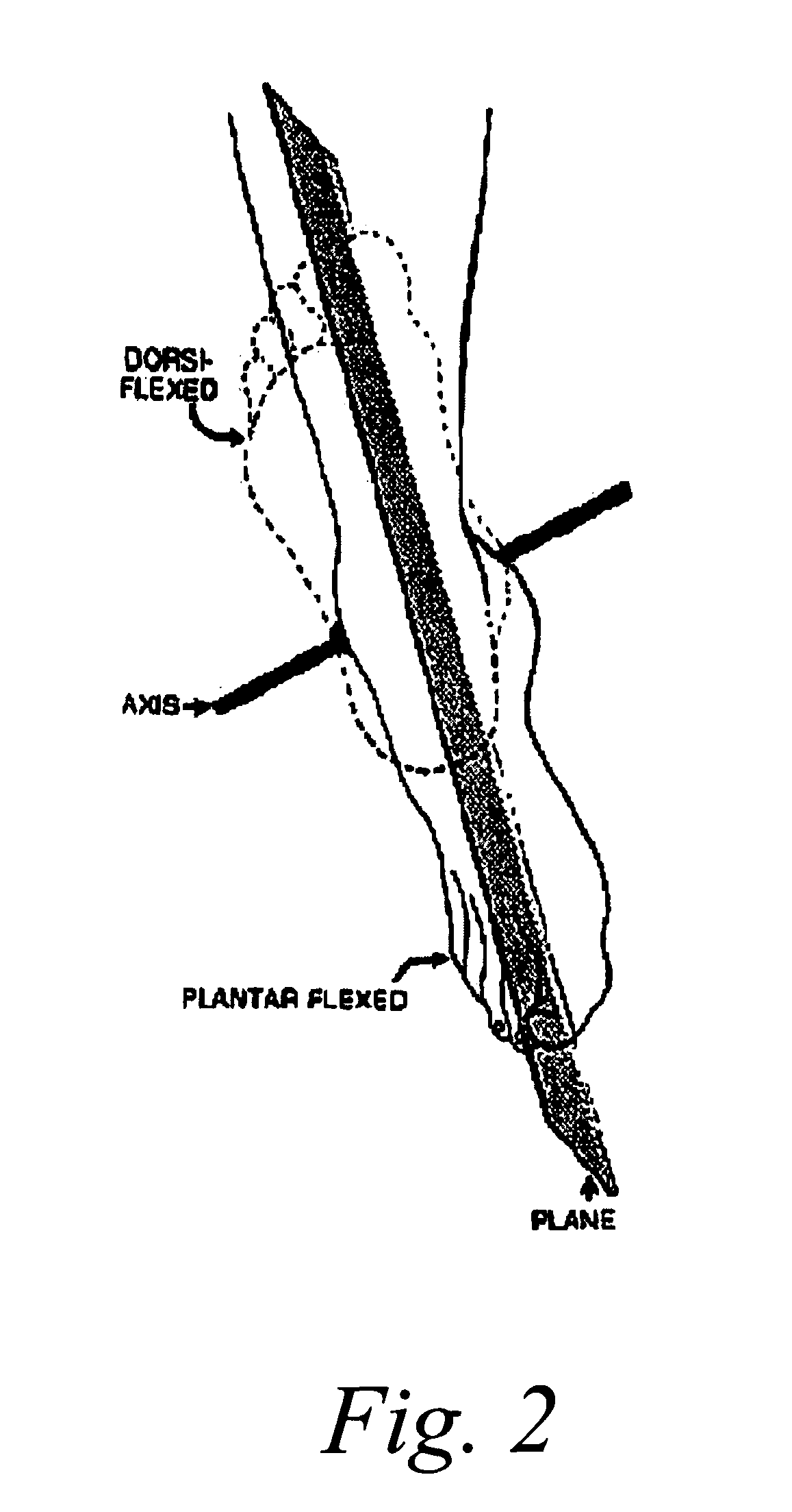 Ankle derotation and subtalar stabilization orthosis