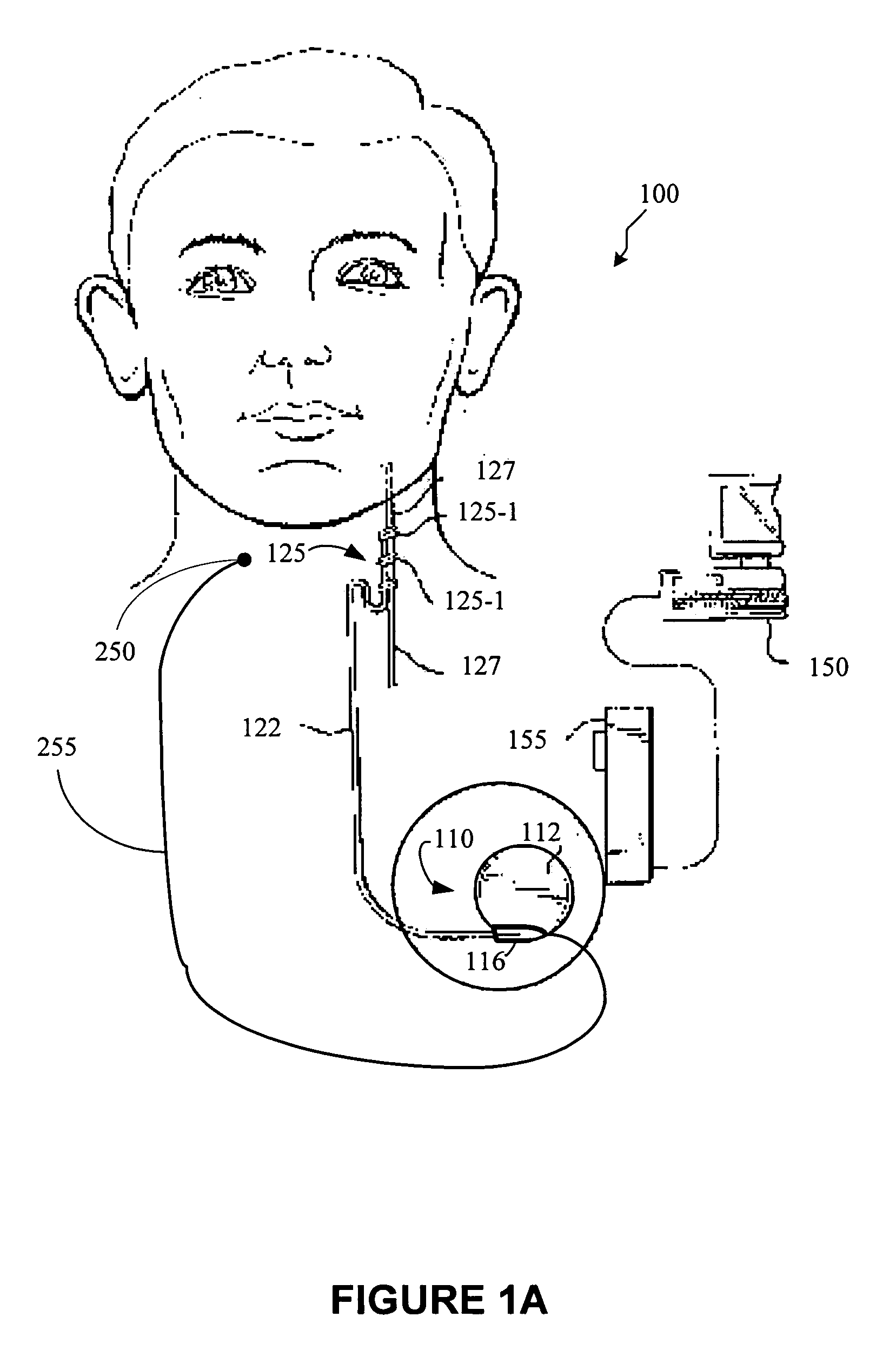 Using physiological sensor data with an implantable medical device