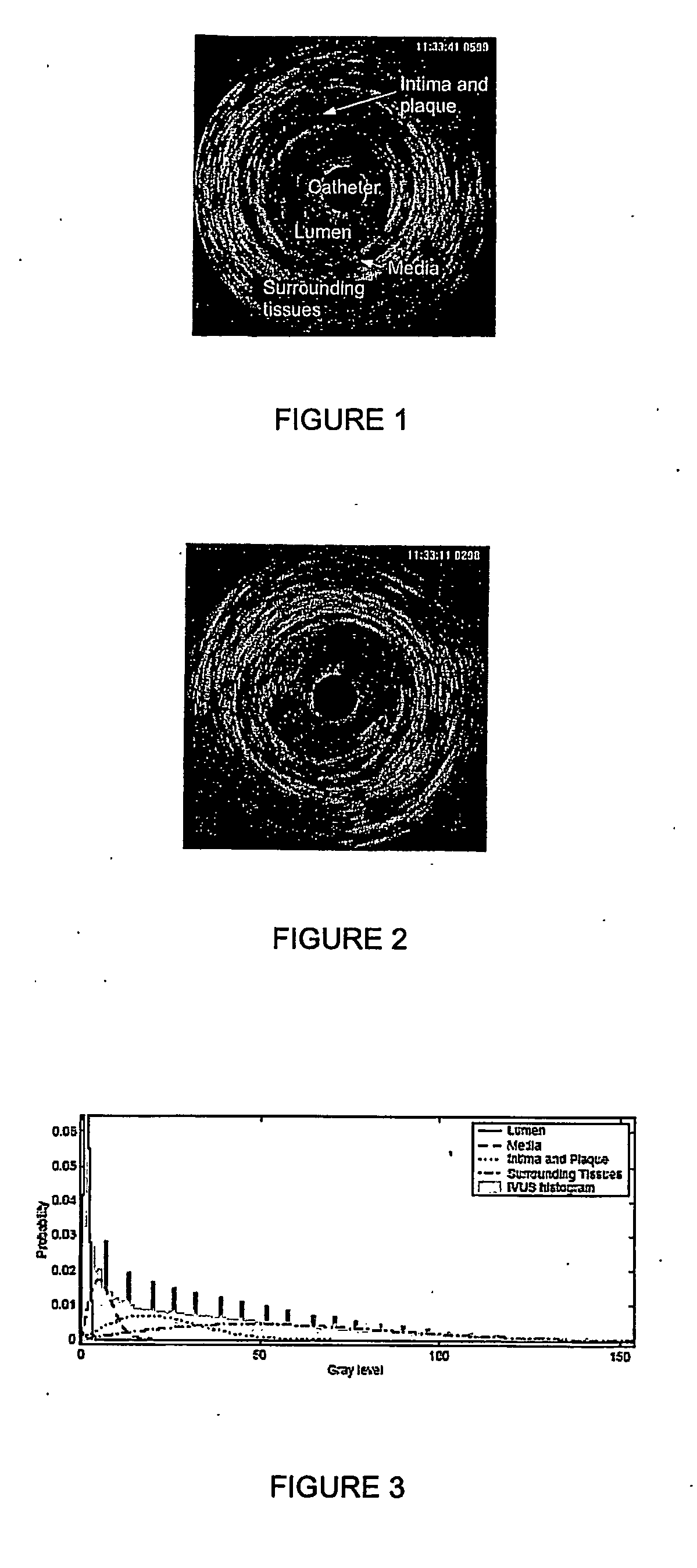 Automatic multi-dimensional intravascular ultrasound image segmentation method