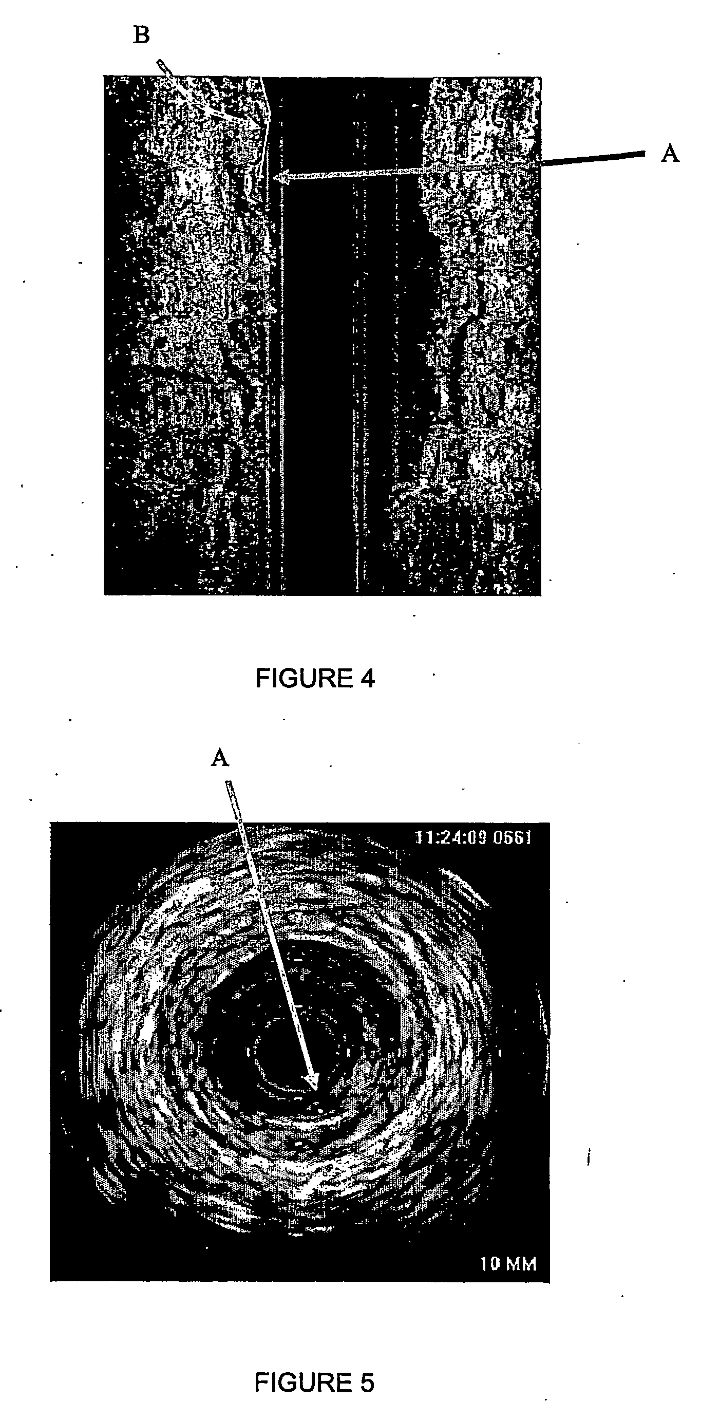 Automatic multi-dimensional intravascular ultrasound image segmentation method