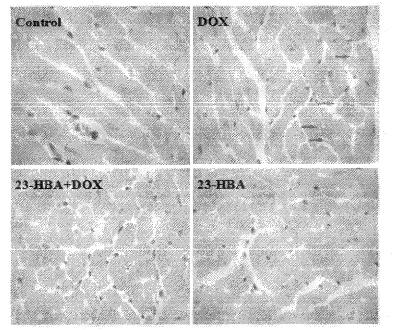 Application of 23-HBA for preparing drug to reduce cardiotoxicity caused by adriamycin