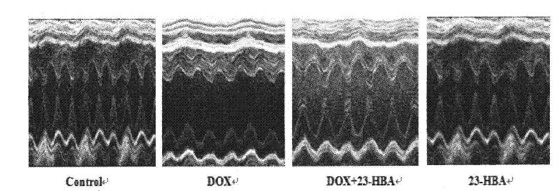 Application of 23-HBA for preparing drug to reduce cardiotoxicity caused by adriamycin