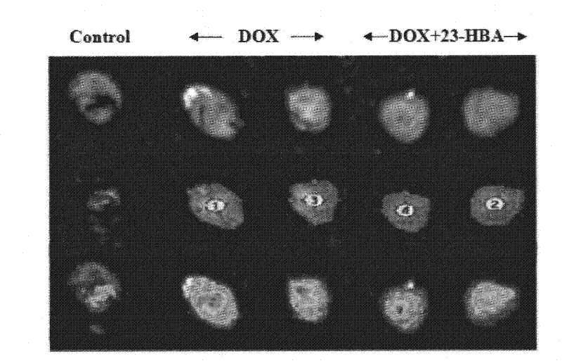 Application of 23-HBA for preparing drug to reduce cardiotoxicity caused by adriamycin