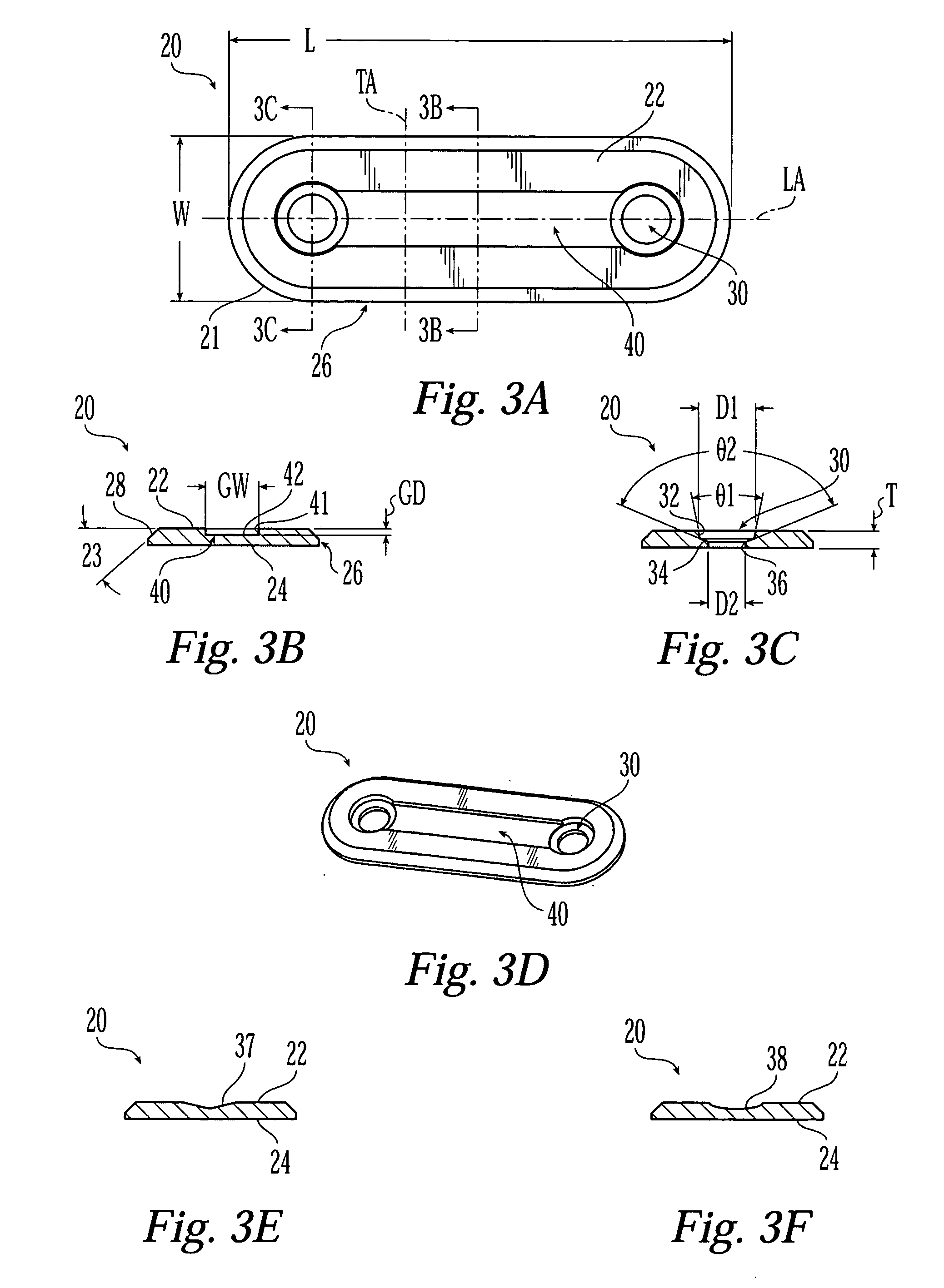 Bone fixation implants