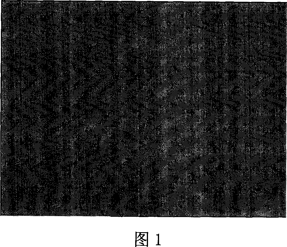 Amnion stroma tectorial blood vessel internal branch and preparing method thereof