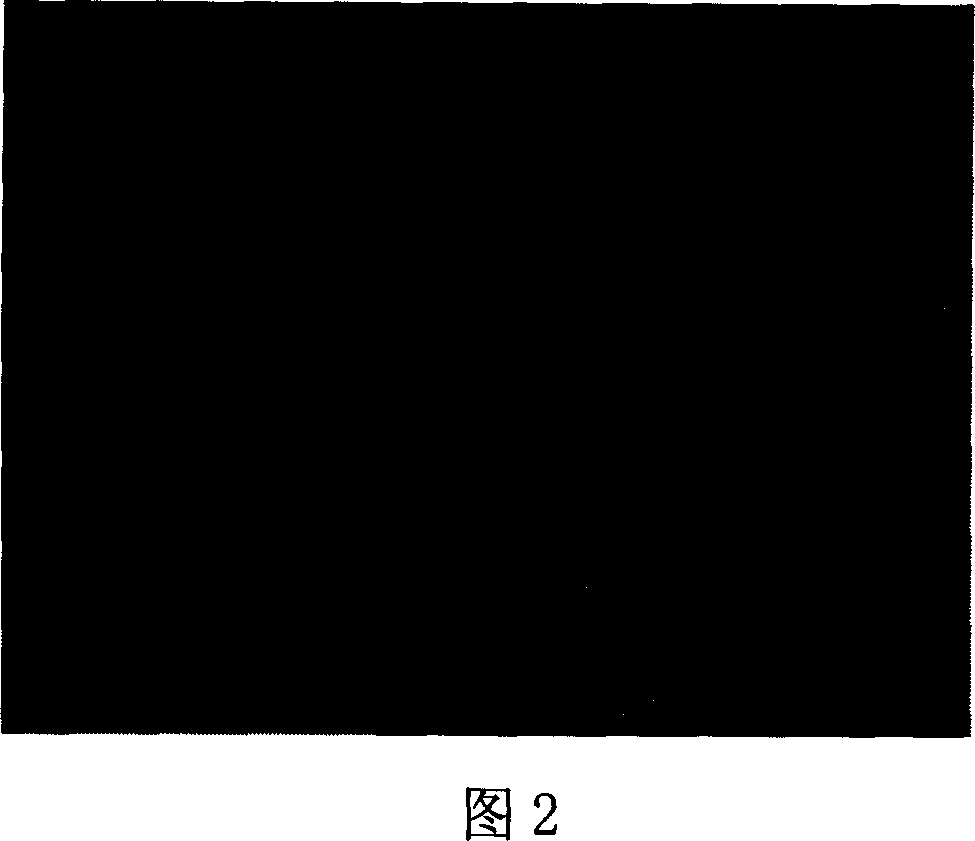 Amnion stroma tectorial blood vessel internal branch and preparing method thereof