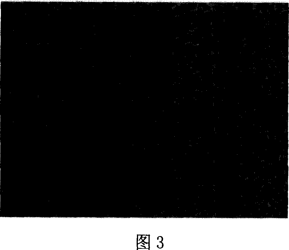 Amnion stroma tectorial blood vessel internal branch and preparing method thereof