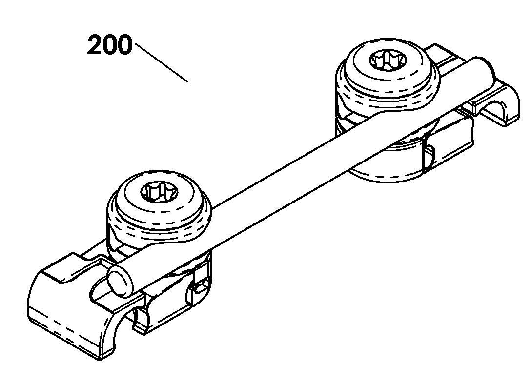 Spinal stabilization system