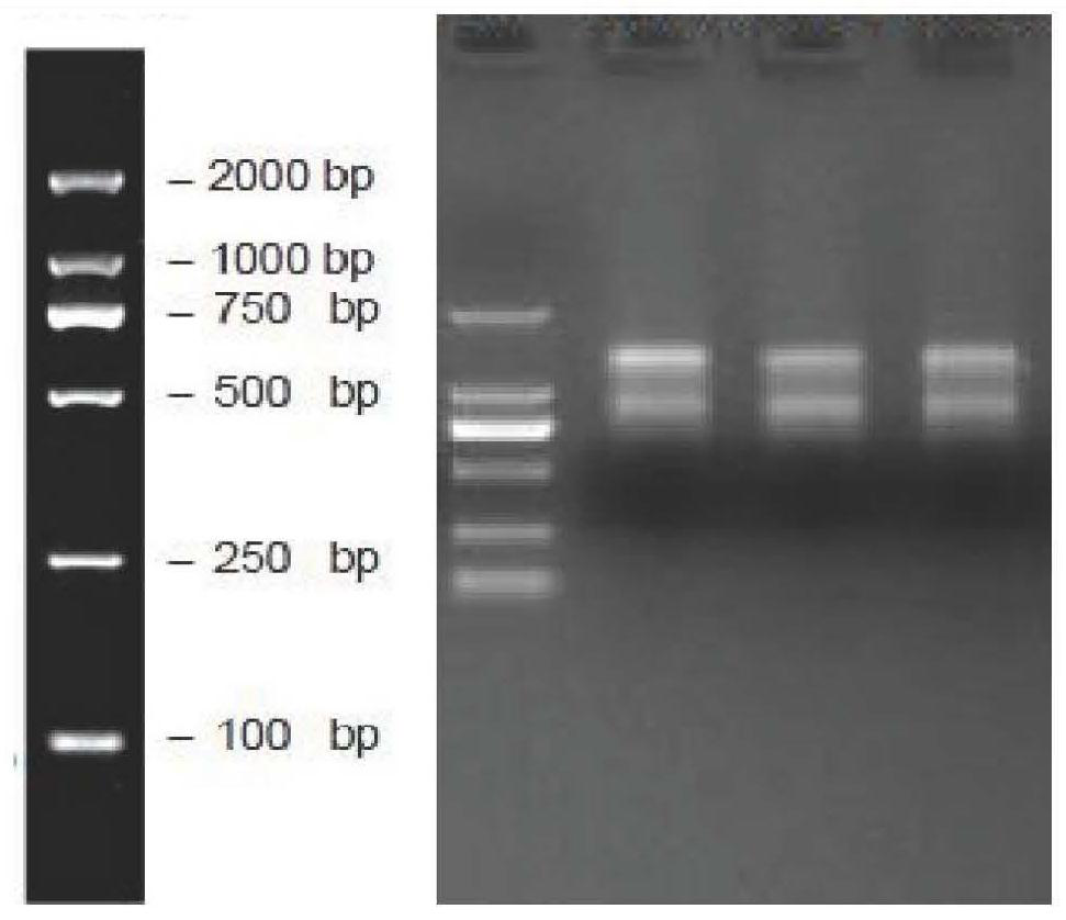 Liriodendron sino-americanum adventitious root promoting factor LhWRKY1 gene and application thereof