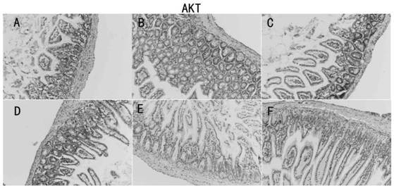 A traditional Chinese medicine compound preparation for regulating intestinal barrier function and preparation method thereof