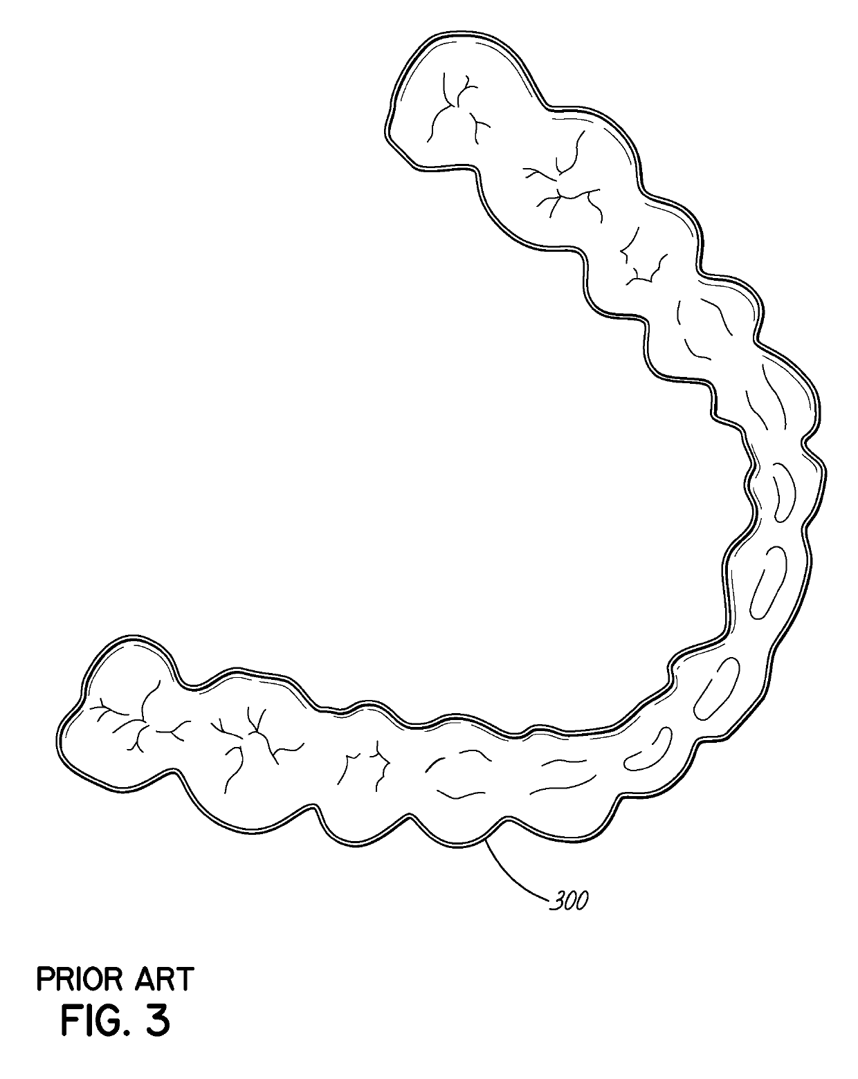 Direct manufacture of orthodontic aligner appliance