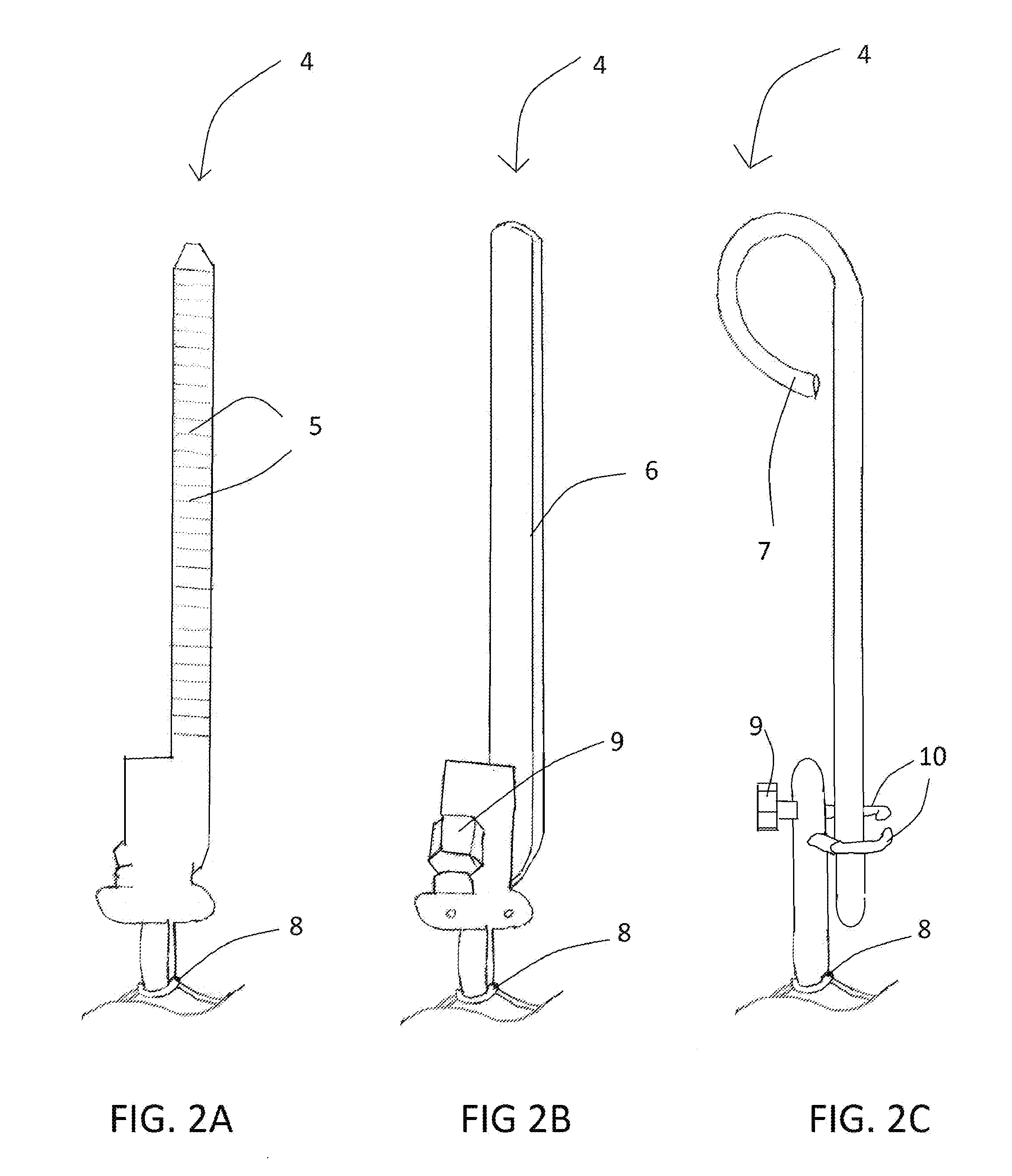 Suspendable organ transplant system and method of use