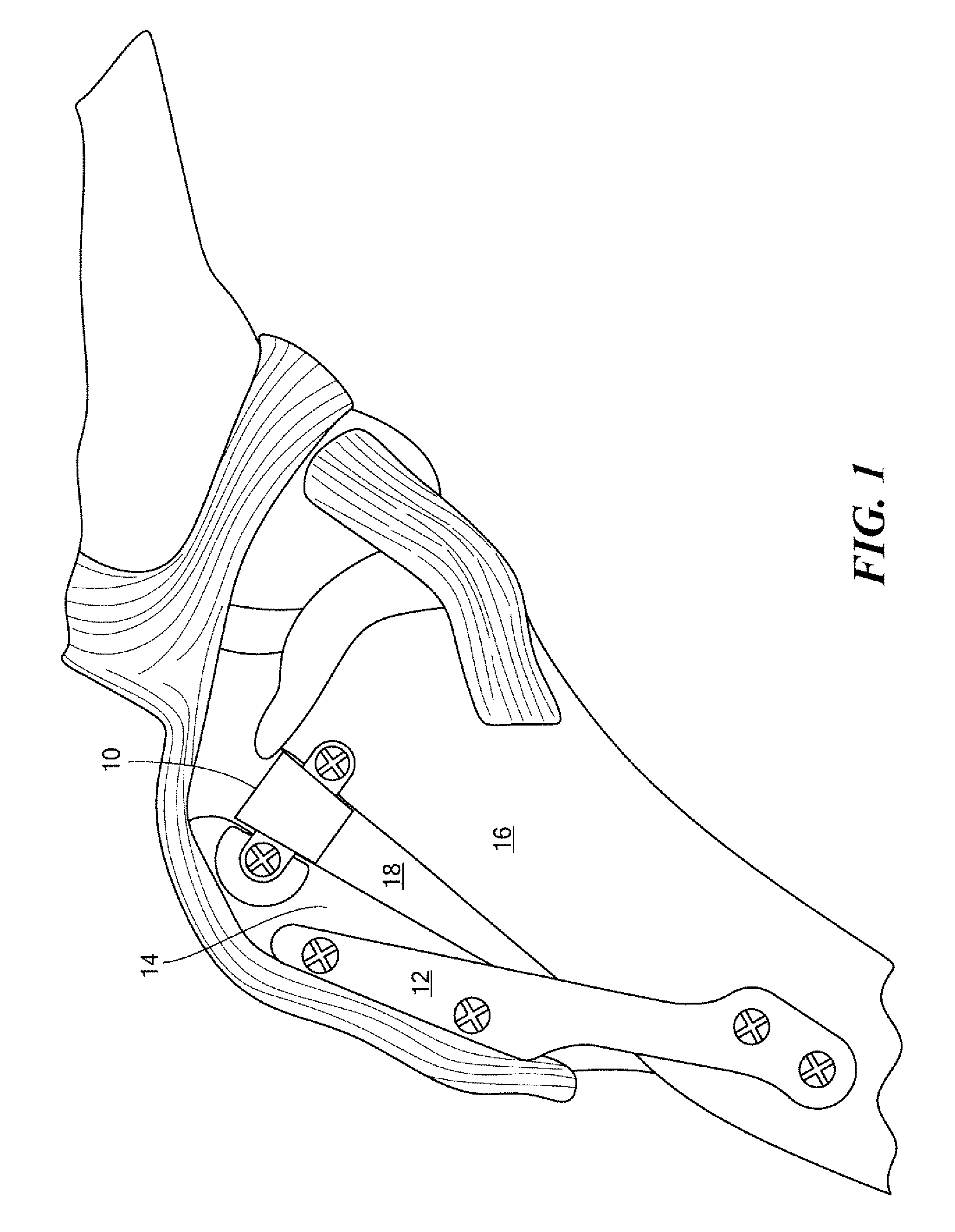 Tibial tuberosity advancement implant