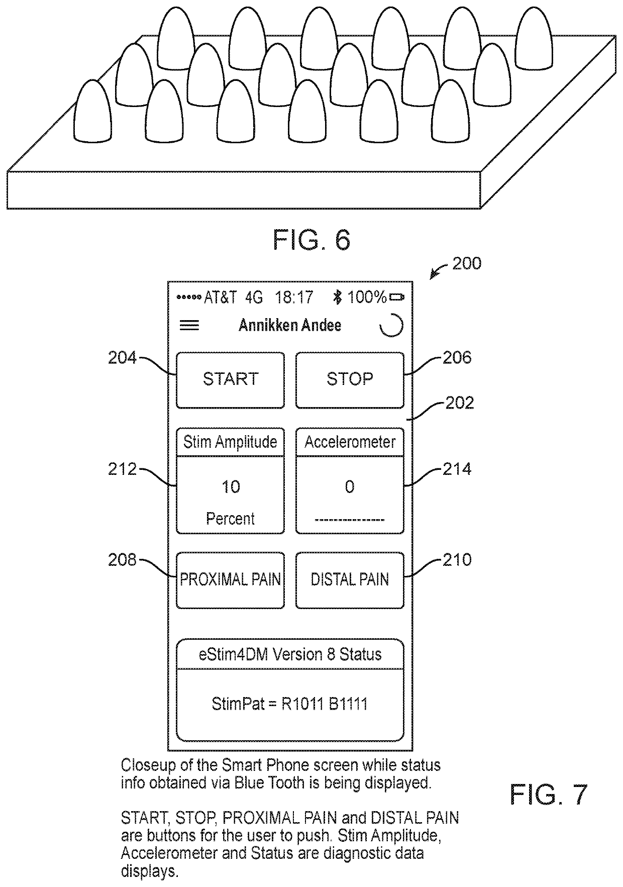 Devices, systems and methods for therapeutic muscle stimulation