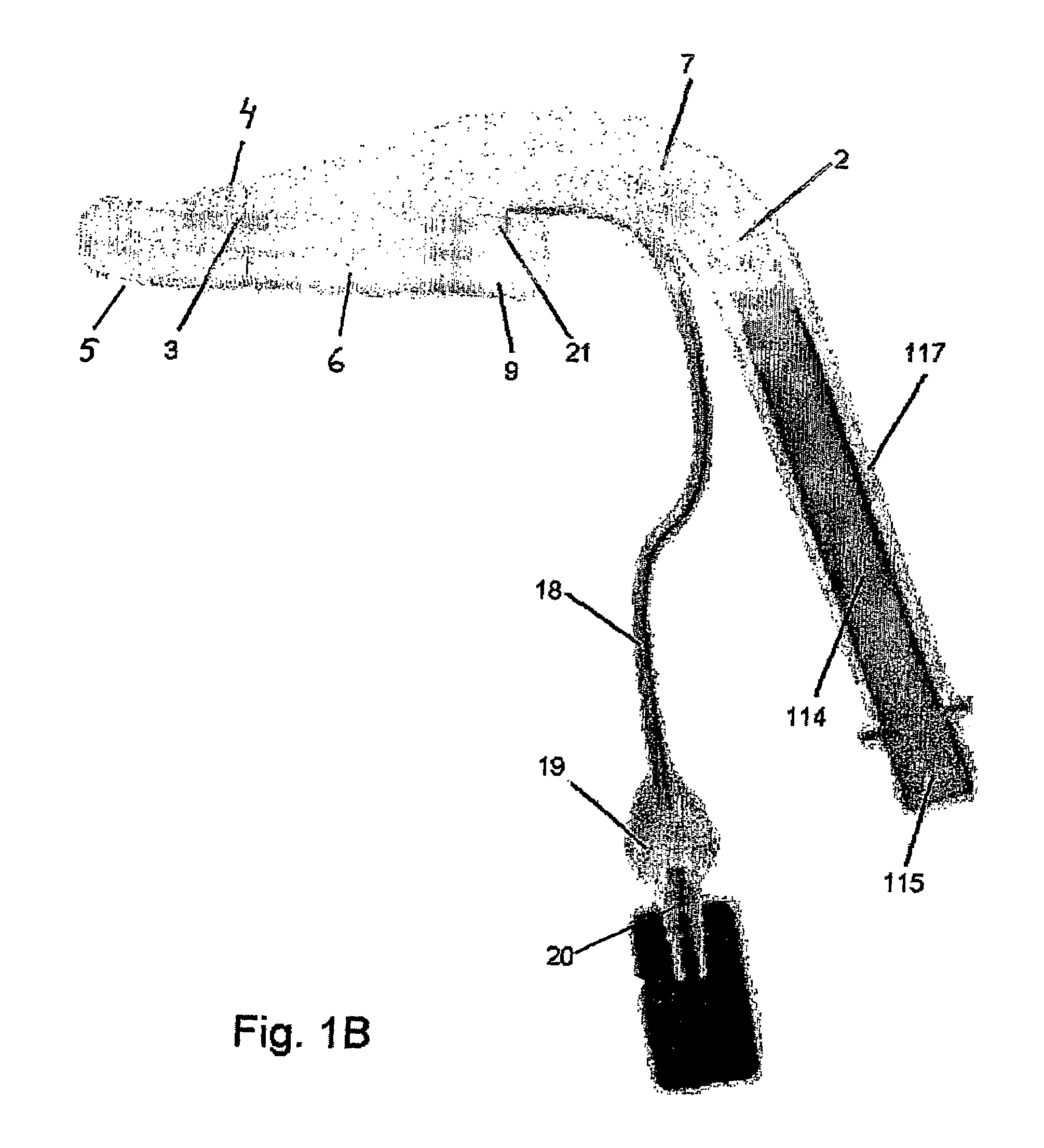 Laryngeal mask and a method manufacturing same