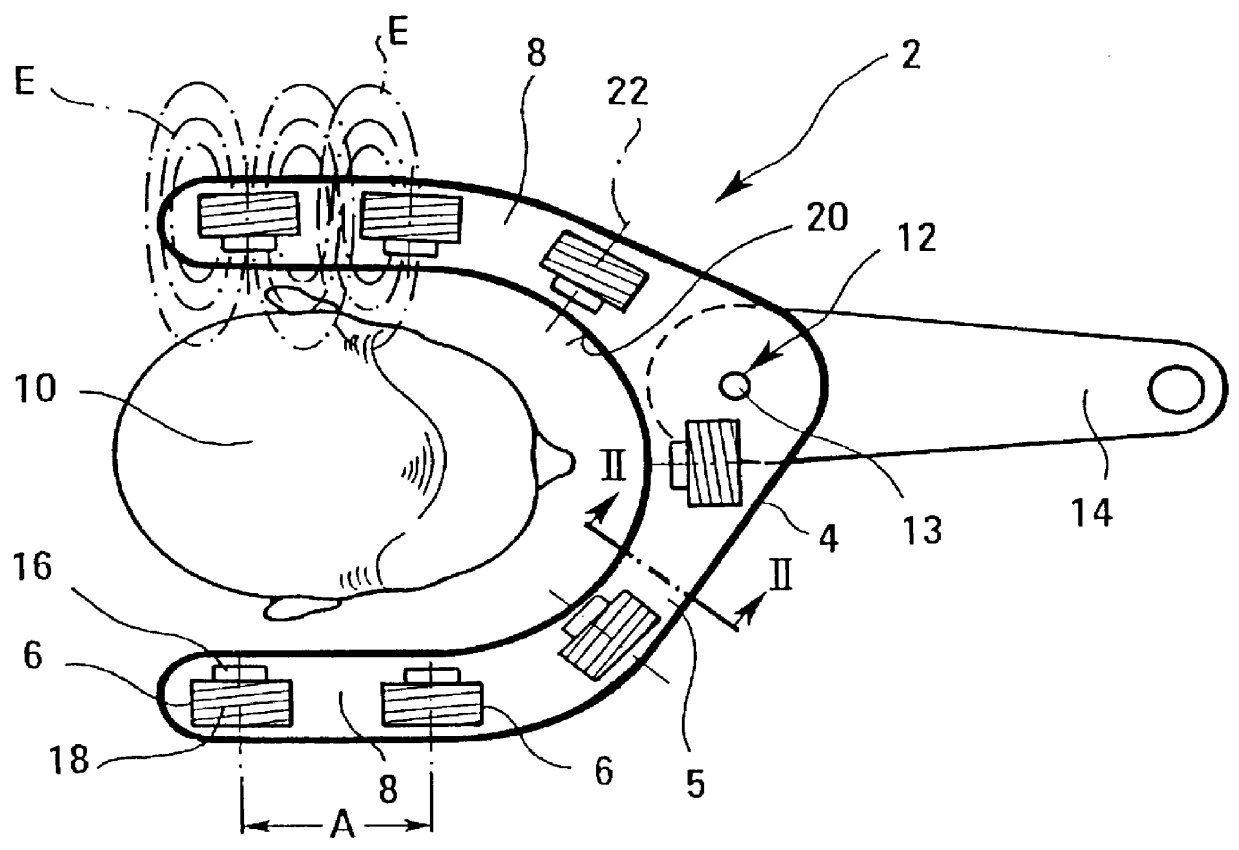 Apparatus for the treatment of disorders of tissue and/or the joints