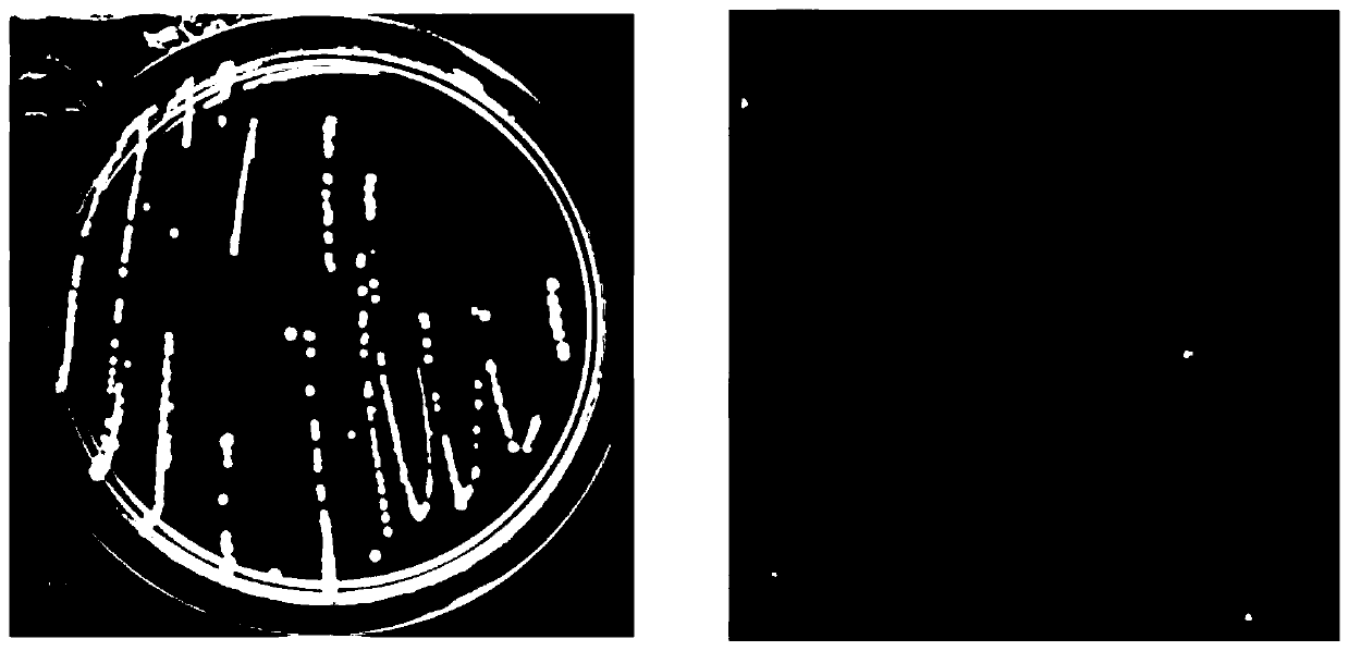 Intermediate rhizobium strain with phosphorus-dissolving property and application thereof